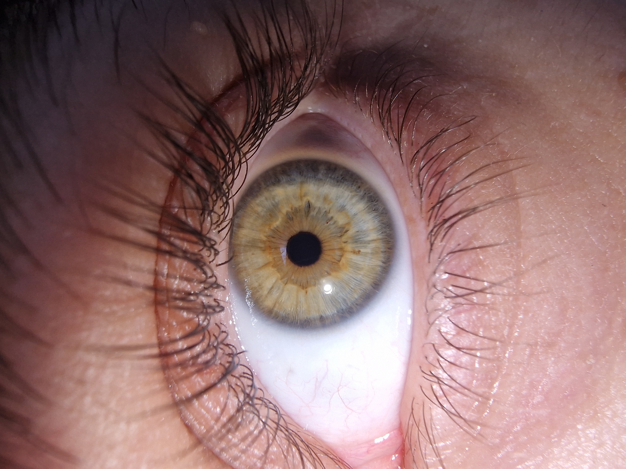 Close-up image of a human eye. The eye has a hazel iris with a black pupil. The eyelashes are dark and dense. The sclera (white part) of the eye has visible blood vessels. The skin around the eye is light-toned and shows texture. Location and time of day cannot be determined from this image.