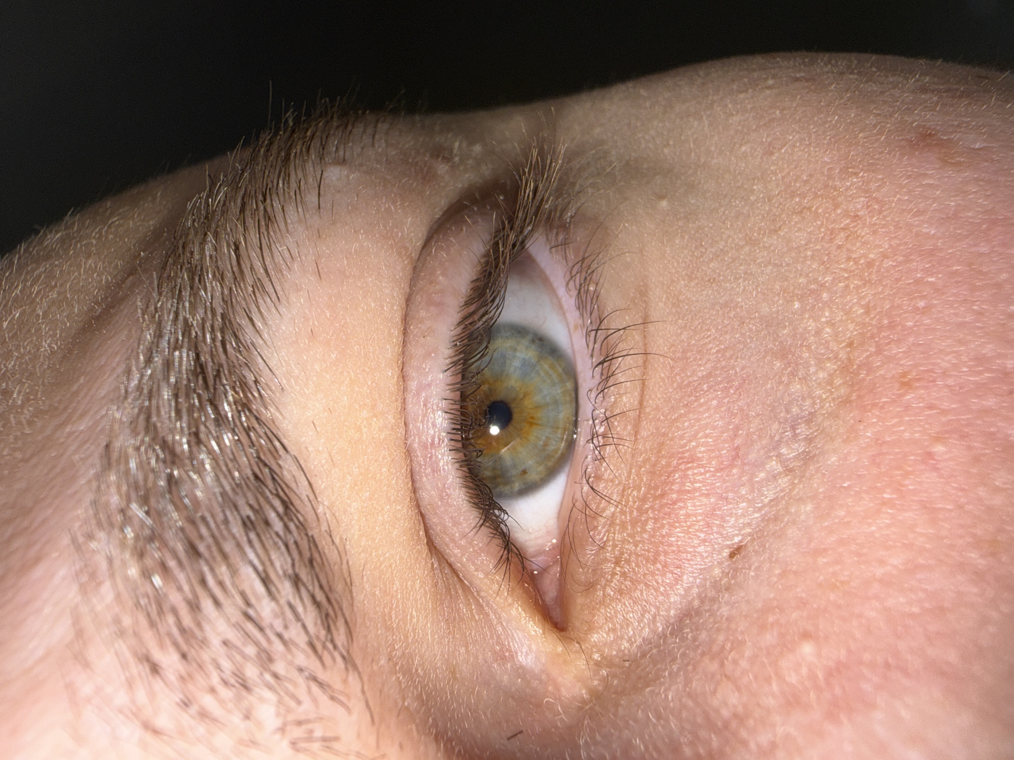 The image presents an extreme close-up of a human left eye and the surrounding facial integument. The iris displays central heterochromia, characterized by an amber-brown inner ring encircling the pupil, which transitions to a blue-green or hazel coloration in the outer perimeter. The pupil is centrally located, dark, and exhibits a distinct specular highlight. Dark, fine eyelashes are present along both the superior and inferior palpebral margins. The eyebrow, composed of dark brown hairs, is partially visible superior to the eye. The surrounding skin is fair-toned, revealing textured epidermis, fine vellus hairs, and minor superficial dermatological features, including small, raised papules and a singular dark mole situated inferior to the eye. The background is uniformly dark and out of focus. The recorded location is Stara Zagora, Bulgaria.