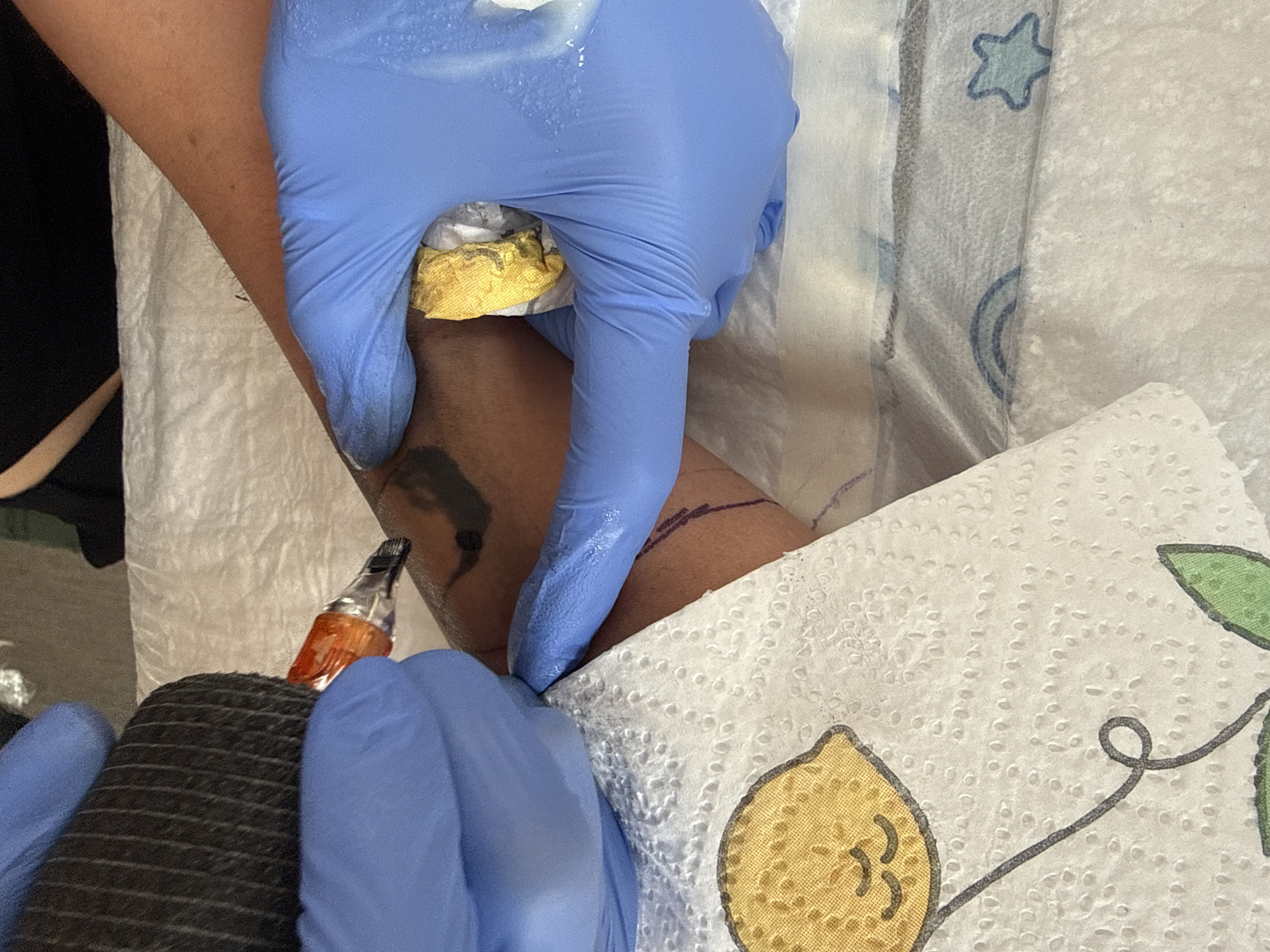 The image shows a close-up of a person's arm being tattooed. The arm is resting on a white paper towel with a lemon design. A tattoo gun, covered in black grip tape and with an orange needle cartridge, is being held by a person wearing a blue glove. Another blue-gloved hand is holding a piece of yellow material against the arm, possibly to keep it taut or to absorb excess ink. The background is blurred, but appears to be a surface covered with white material, possibly a medical or tattoo studio setup. The scene is brightly lit, with the focus on the tattooing process. The specific location in Budva, Montenegro cannot be determined from the image.
