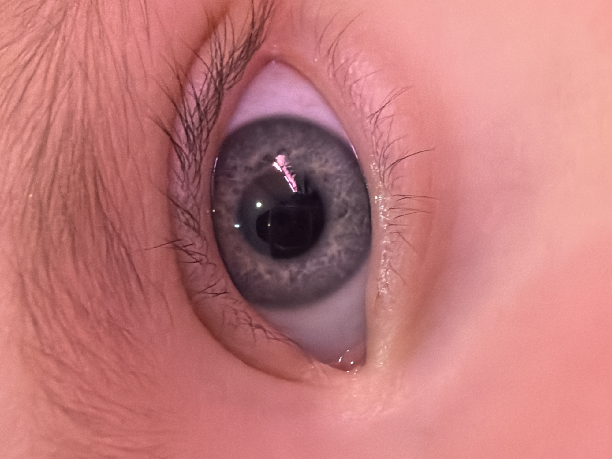 A close-up photograph shows a gray eye with black pupil, surrounded by eyelashes, and skin with fine hair. There is a small droplet of fluid in the corner of the eye. No information indicates a location in Chaikovsky, Russia.