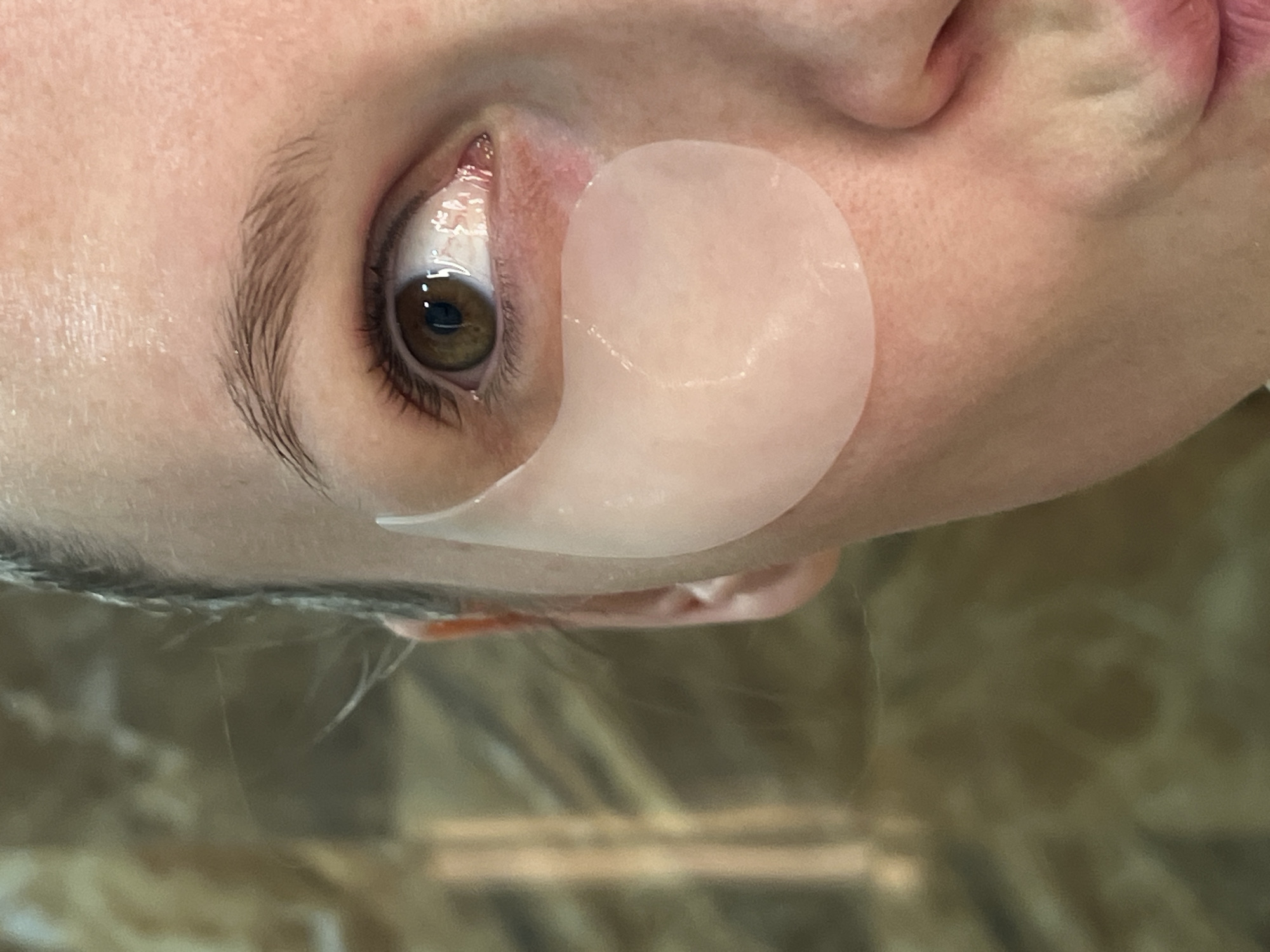 A close-up, slightly rotated image shows a person's face with a light pink under-eye patch applied below the left eye. The person has fair skin, brown eyes, and light eyebrows. The background is blurred and appears to be an interior space with neutral tones. There is no indication of a specific location within Khimki, Russia or of any actions or interactions beyond the application of the eye patch.