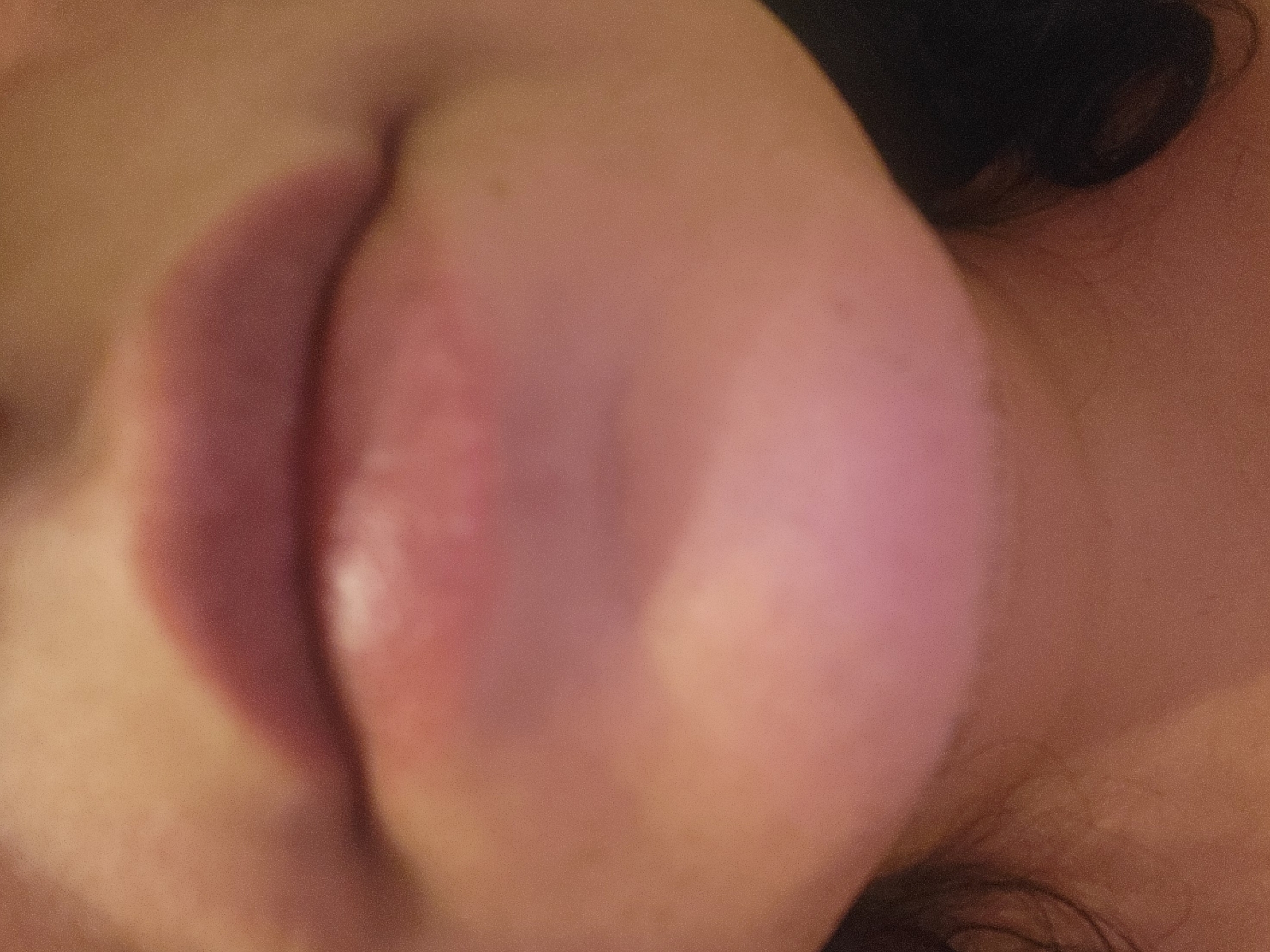The image is a close-up, low-angle, portrait-style photograph focused on the lower face of a person, specifically their mouth and chin area. The skin tone appears to be fair to medium. The lips are slightly parted and are colored with a dark pink or plum-colored lipstick. The chin is rounded and shows a soft transition of skin tone, with a slightly more reddish hue in the center. The background is out of focus and appears to be a neutral, possibly indoor environment with warm lighting. There are no discernible landmarks or environmental clues to suggest a specific location within Pinneberg, Germany. The image is grainy, indicating it was likely taken with a mobile device or in low light conditions.