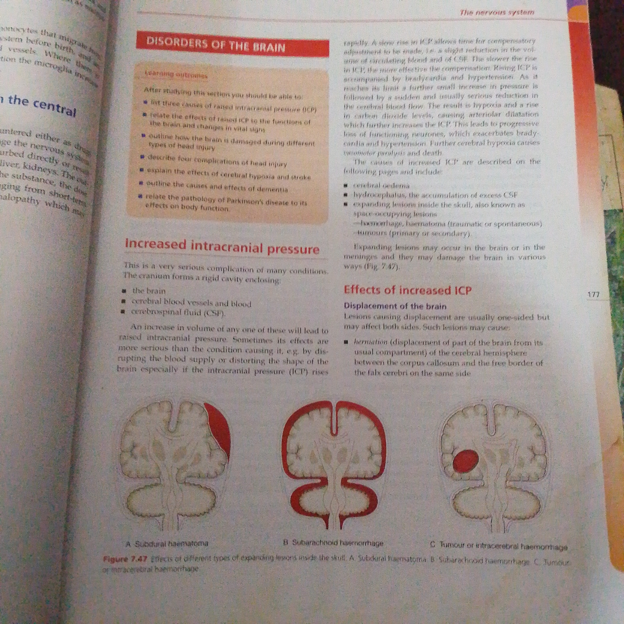 The image shows a page from a textbook discussing disorders of the brain and increased intracranial pressure. The text is organized into sections with headings, bullet points, and accompanying diagrams.
The left side of the page has a heading "on the central" followed by text describing the nervous system.
The middle section of the page has a red heading "DISORDERS OF THE BRAIN". Below this is a "Learning outcomes" section with bullet points. Further down, there is a heading "Increased intracranial pressure" followed by explanatory text and a list.
The right side of the page contains more text related to increased intracranial pressure, with a heading "Effects of increased ICP". This section discusses displacement of the brain and herniation.
At the bottom of the page, there are three diagrams labeled A, B, and C, illustrating different types of lesions within the skull, specifically "A. Subdural haematoma", "B. Subarachnoid haemorrhage", and "C. Tumour or intracerebral haemorrhage". These diagrams are part of "Figure 7.47 Effects of different types of expanding lesions inside the skull".
The image is a close-up shot of an open book, likely a medical or biology textbook, and does not contain any information or visual cues related to the city of Jalingo, Nigeria, or any forensic scene.