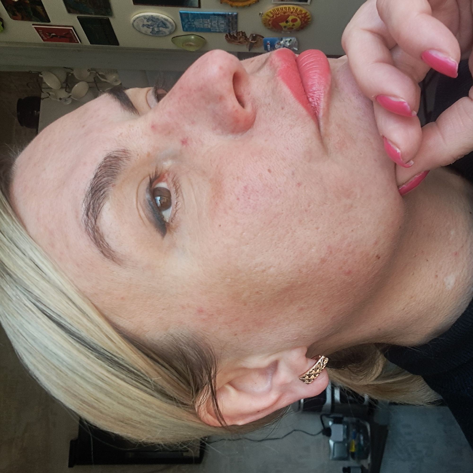 A close-up, portrait-style photograph shows a light-skinned woman with blonde hair and light brown eyes. She is wearing pink lipstick and has pink nail polish on her fingers. The woman is touching her chin with her fingers. She is wearing a gold patterned hoop earring. The skin on her face has a mottled appearance with some redness. The background is out of focus but includes a section of what appears to be a refrigerator covered with magnets. The location and city of Elektrostal, Russia are not evident in the image.