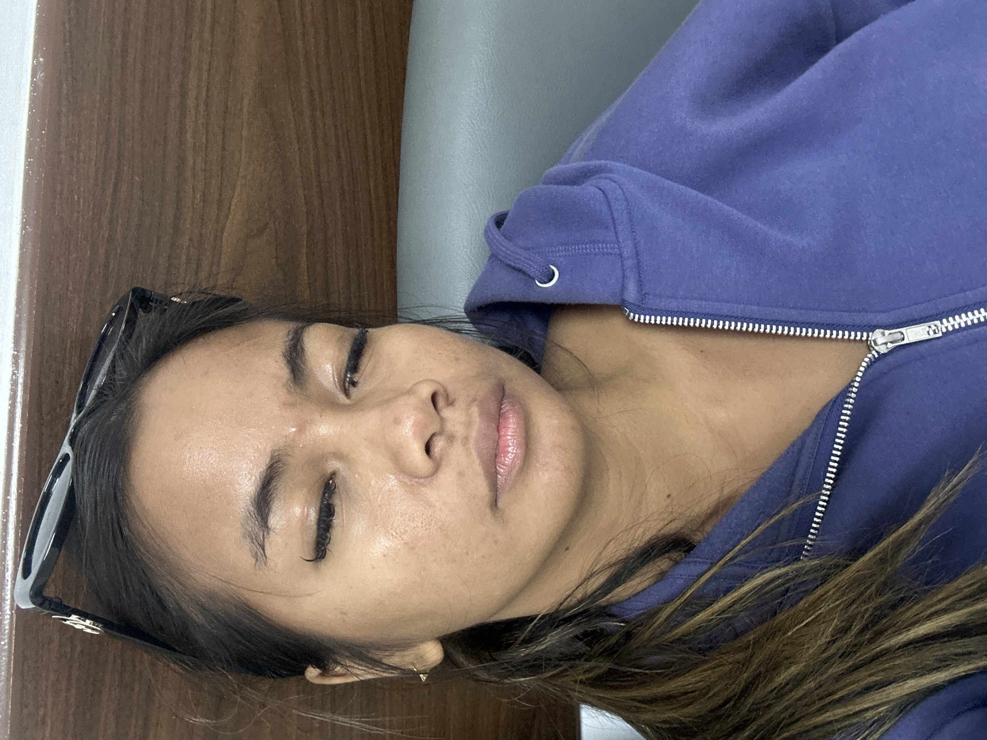 A young woman with her eyes closed is captured in a close-up selfie, her face tilted slightly upwards. She is wearing a purple zip-up hoodie and has dark hair pulled back in a ponytail, with a pair of black sunglasses perched on top of her head. Her skin appears oily and somewhat uneven, with visible pores and some reddish areas. She has long, dark eyelashes and her lips are slightly parted and appear to be glossed. The background is a blurred mix of a wooden surface and a grey upholstered chair, suggesting she is indoors. The lighting is bright, highlighting the sheen on her skin. The image has a candid and perhaps slightly tired feel. The overall composition is a head-and-shoulders shot.