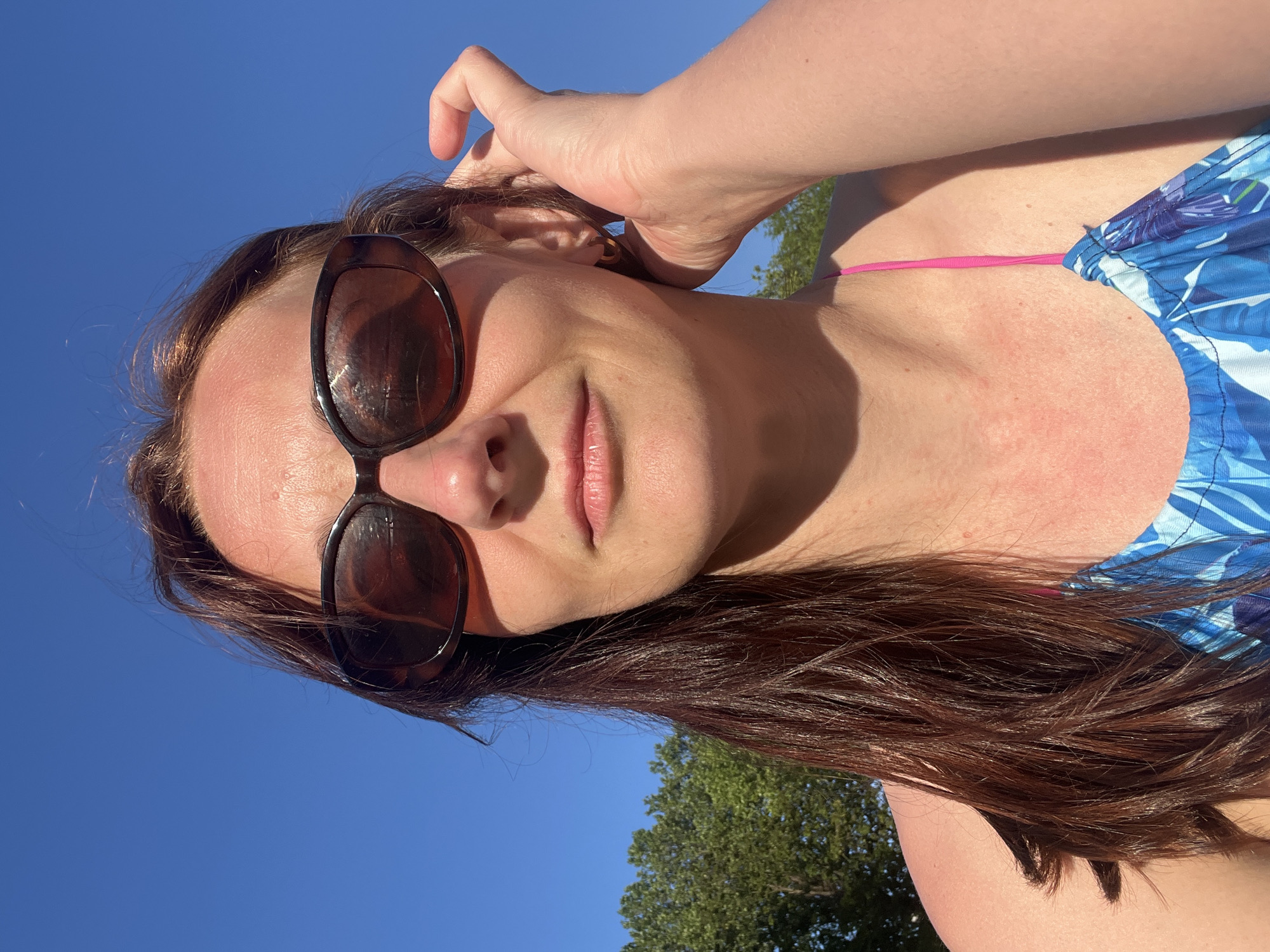 A medium close-up, vertical photograph features an adult female outdoors under direct sunlight. She has long, reddish-brown hair, some strands of which are visibly damp or wet. She is wearing dark, oval-shaped sunglasses that obscure her eyes. Her right hand is raised, with fingers touching her hair and the side of her head above her right ear, which sports a small, gold-toned hoop earring. Her lips are naturally colored and slightly parted. Her forehead, nose, and exposed skin on her chest and shoulders display a reddish hue consistent with sun exposure. She wears a blue garment with a white and purplish-blue tropical leaf pattern; a thin, bright pink strap is visible over her right clavicle, indicative of swimwear or a casual top. The background consists primarily of a clear, cloudless blue sky, with the green canopy of deciduous trees visible in the lower-left portion of the frame, suggesting a natural outdoor environment. Strong, direct sunlight casts distinct shadows on her face and body.