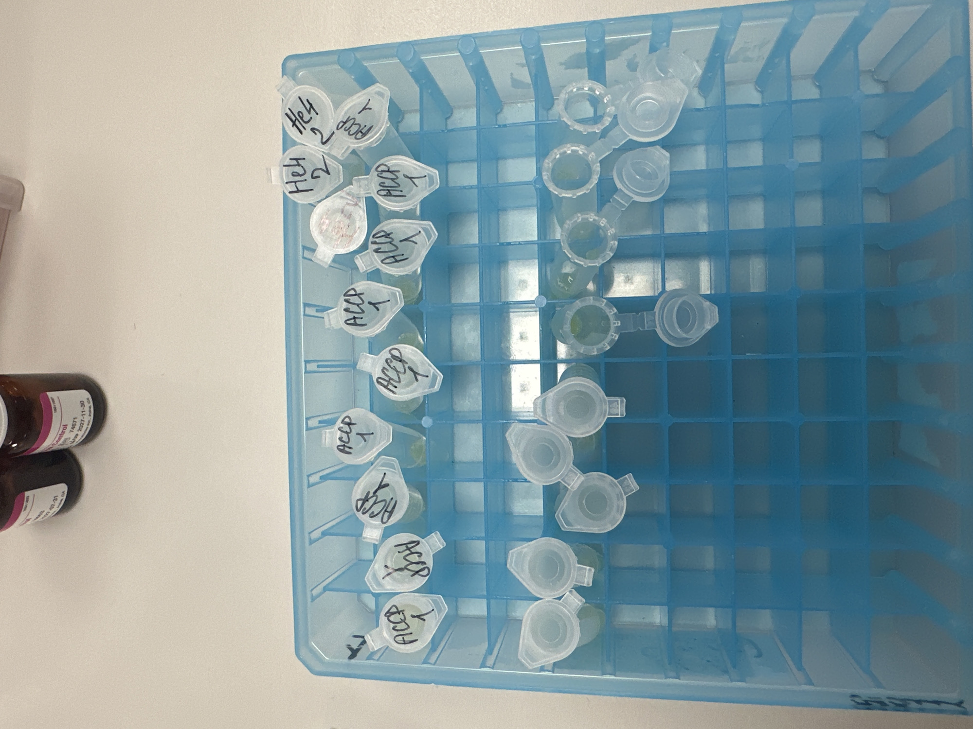 The image shows a light blue plastic test tube rack filled with several small, capped Eppendorf tubes. Some tubes are labeled "HeLa 2" and "ACCP 1" in black marker. Some of the tubes contain a greenish liquid. Several tubes appear empty. The rack sits on a white surface, with two dark brown bottles with labels on the left side of the frame. The location is unspecified, and there is no evidence to suggest it is in Moscow, Russia.