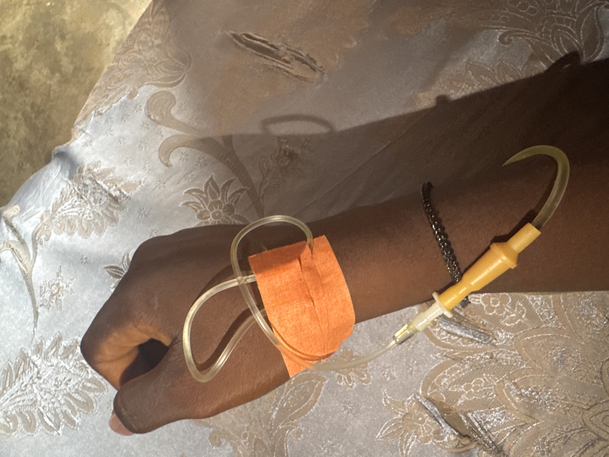 An adult human arm with an IV infusion tube is visible. The IV tube is taped to the arm with orange medical tape. The arm is resting on a patterned beige and white textile. The setting appears to be indoors. There is no explicit information to support a location in Oboama, Nigeria.