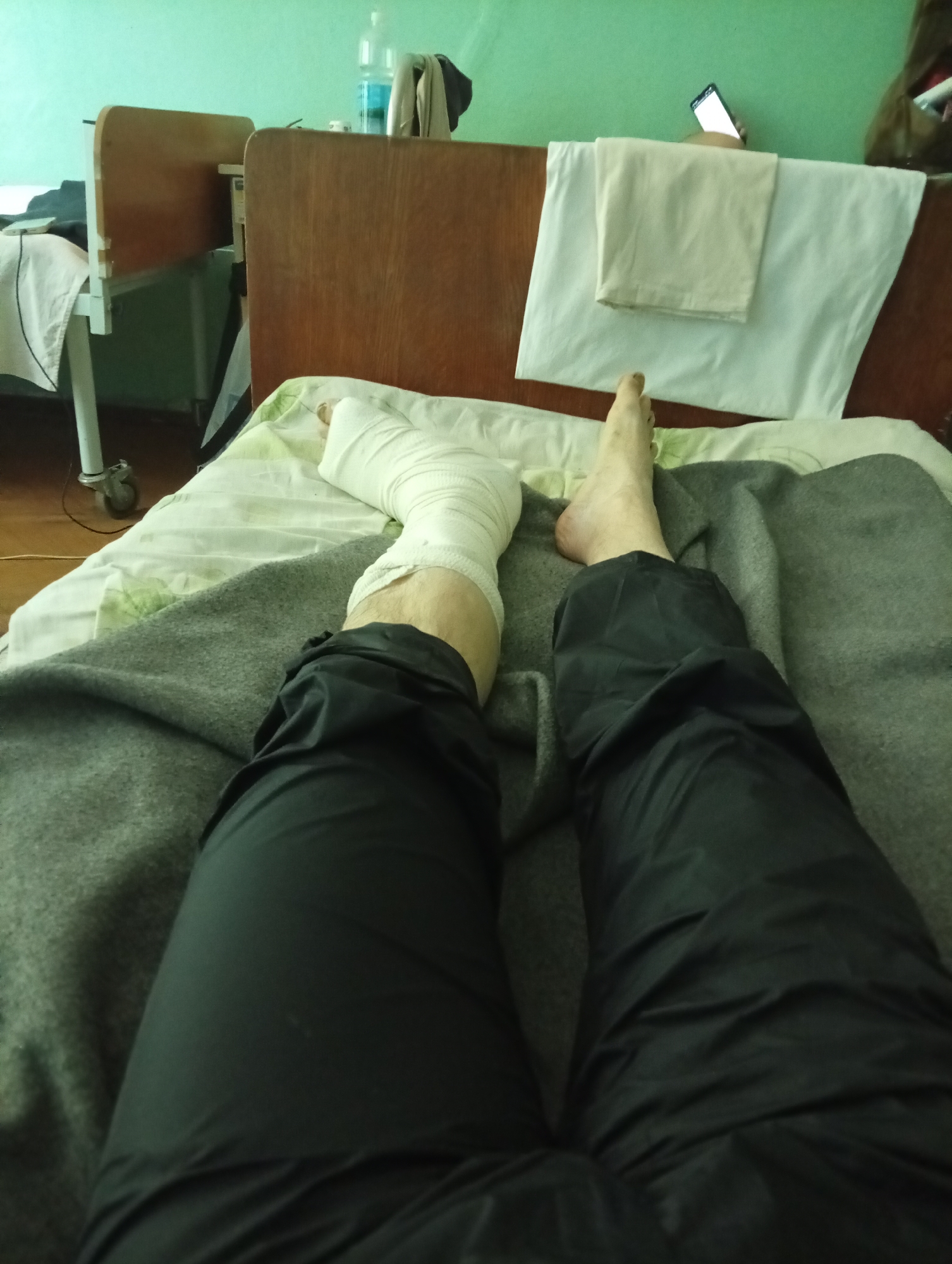 The photograph presents a first-person view of a person lying on a hospital bed. The individual is wearing black pants and has a white bandage wrapped around their left leg and foot. Their right leg is exposed. The bed is covered with a patterned sheet and a gray blanket. A wooden headboard is visible, with a white towel draped over it. A bedside table with a white cloth is seen on the left. A mobile phone is resting on the headboard, near a water bottle. The environment appears to be a hospital room. The location is in the city of Unknown, Unknown.
