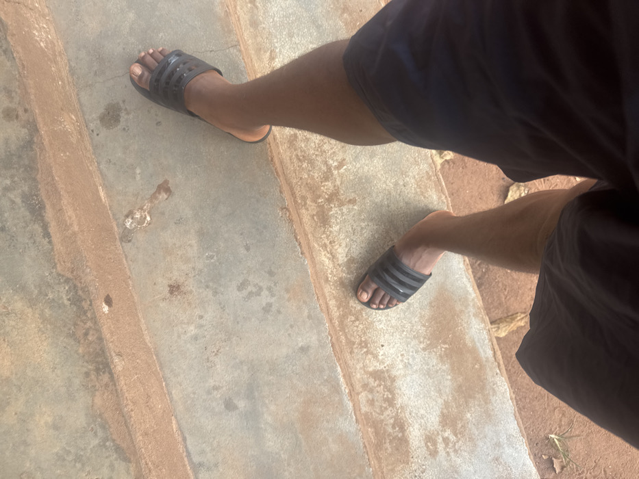 A view from above shows legs and feet on a stone-like surface with a textured or uneven border. The person wears black Adidas-style slides. The legs are angled, with one foot positioned higher in the frame than the other. The person is wearing dark shorts. The overall perspective suggests a casual or candid snapshot of someone standing on a rough or outdoor surface. The lighting appears to be natural.