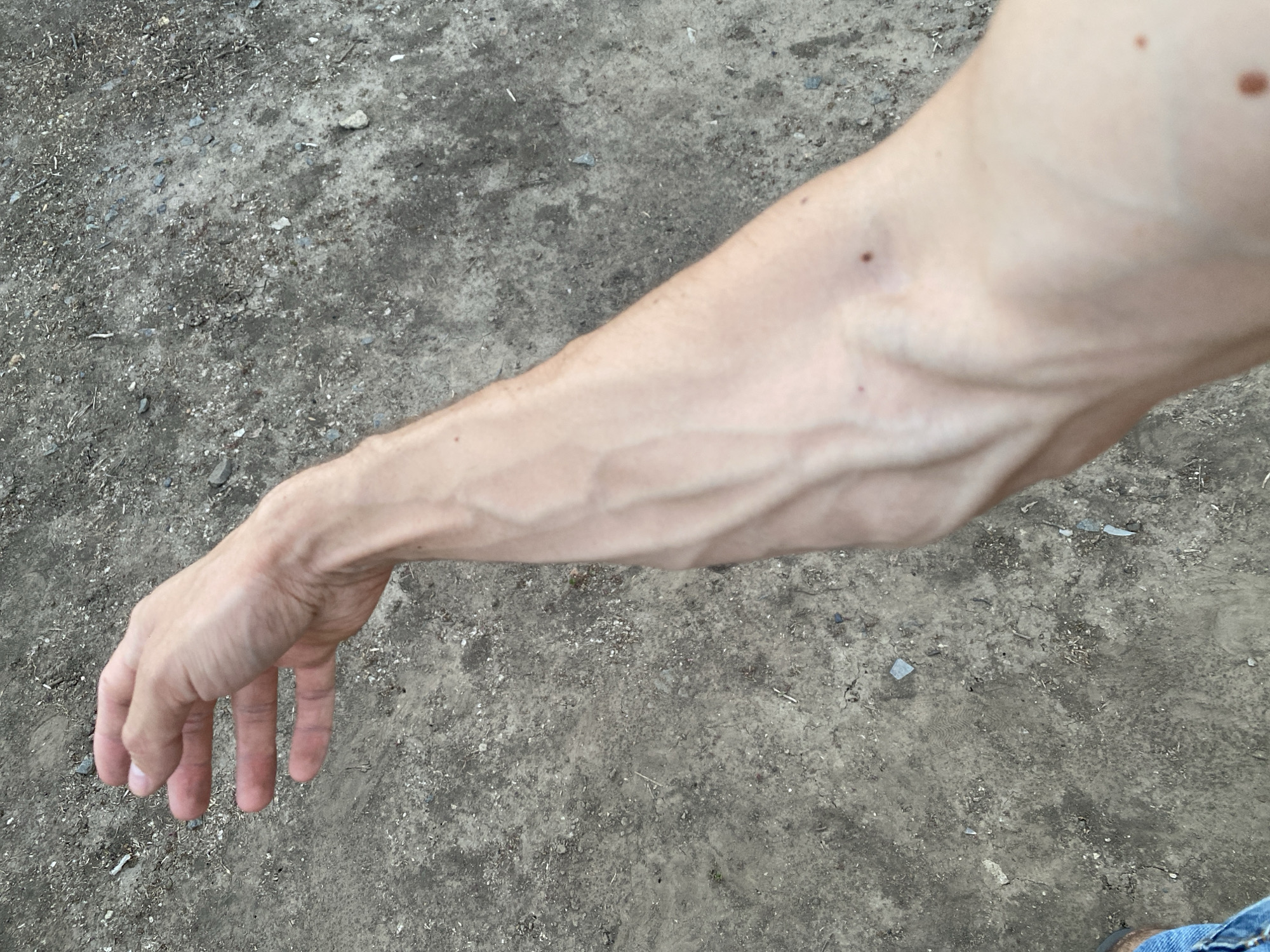 The image shows a close-up view of a person's arm and hand. The arm is extended, with prominent veins visible on the surface of the skin. The hand is relaxed, with fingers slightly curled. The background is a rough, gray surface, possibly dirt or gravel. There is no indication of the location being Cairaclia, Moldova.