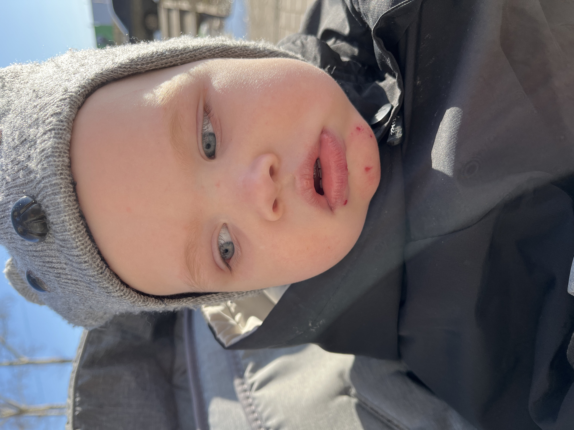 The image is a close-up of a baby lying down, presumably in a stroller, as indicated by the quilted fabric surrounding them. The baby has pale skin, light-colored eyes, and is wearing a gray knit hat with button embellishments. There are small spots of blood or injury near the baby's mouth and on their cheek. The baby is wearing a dark-colored jacket. The location is impossible to determine with the provided information. There are a few tree branches visible in the blurred background.
