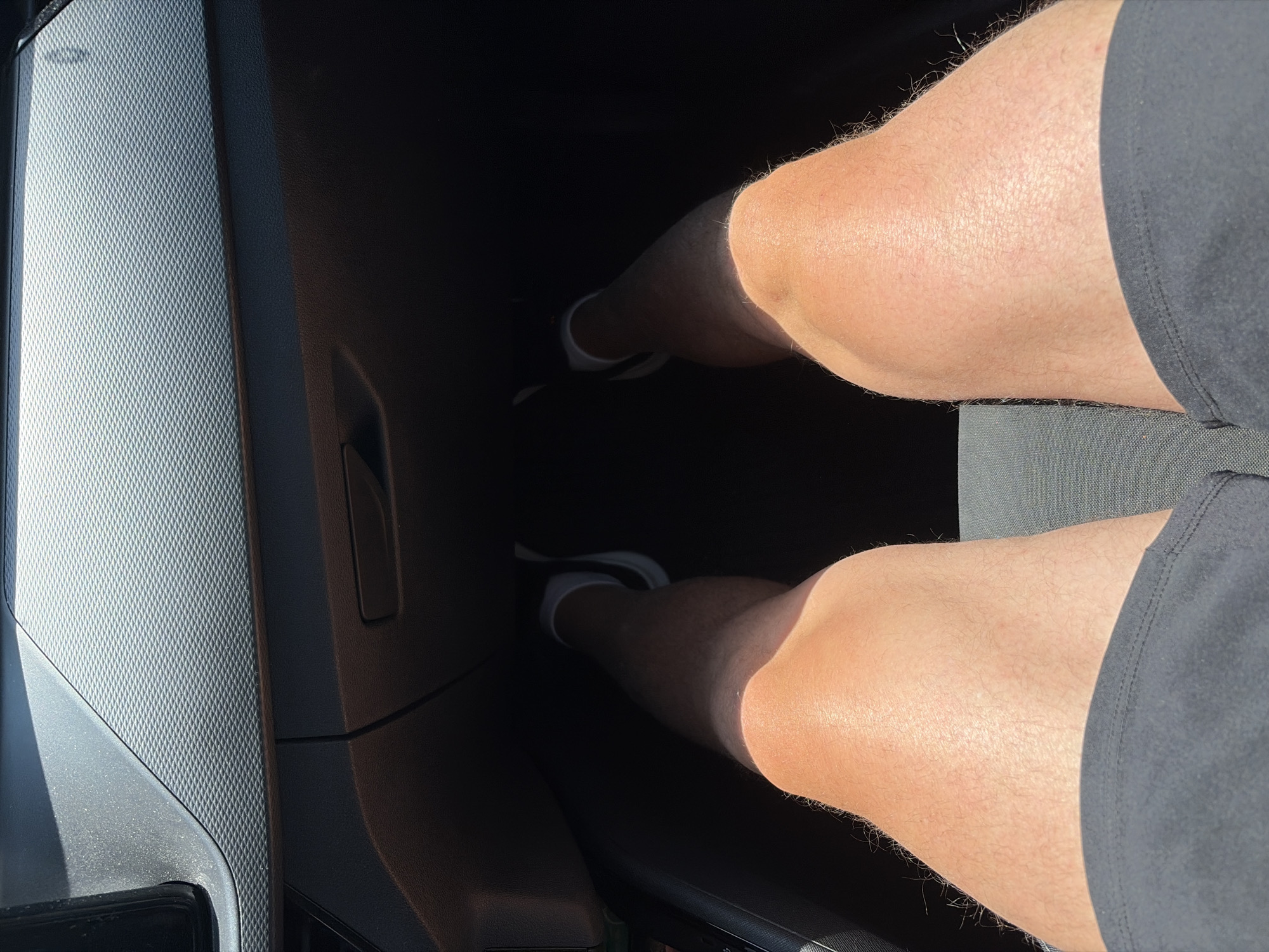 A high-angle, medium shot shows the lower body of a person sitting inside a vehicle, facing forward. The person is wearing black shorts and white and black athletic shoes. Their legs are exposed and appear to be sunburned. The interior of the vehicle is dark, with the dashboard visible at the top of the frame. Sunlight streams in from the right side, illuminating the person's legs. The scene takes place in the car's footwell. The image was taken in Đuraševići, Montenegro.