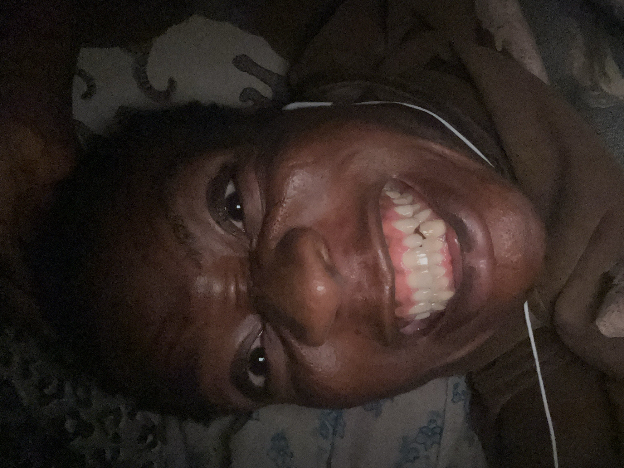 A close-up, tilted, dark-lit indoor shot depicts a dark-skinned individual lying down with their head on patterned bedding. The person is smiling widely, revealing their teeth. A white wire is visible near the right side of the face. The location is unknown.