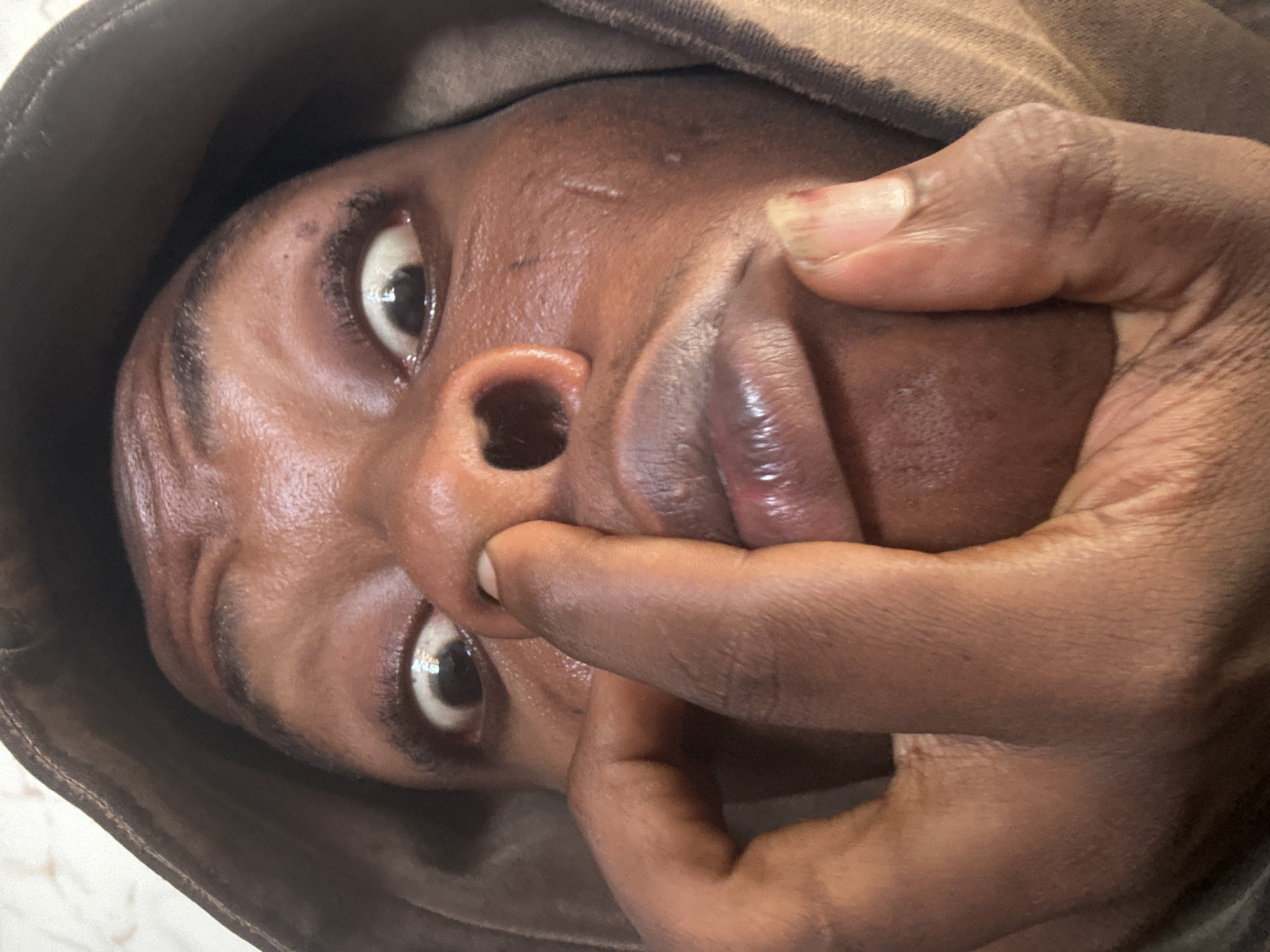 The image is a close-up, distorted, and rotated shot of a person's face and hand. The subject's skin is dark, and they are wearing a brown hooded garment that covers their head and neck. Their eyes are wide open, with one visible in the frame, looking upwards and to the left. The hand, also with dark skin, is positioned in front of the face, with fingers obscuring part of the nose and mouth. The thumb of the hand is pressing on the side of the nose, near the nostril. The lips appear slightly parted. The overall lighting is dim, with some highlights on the skin. The image is likely taken indoors, given the close-up nature and lack of external environmental cues. There are no visible text elements in the image. The orientation of the image suggests it was taken with the camera held at an unusual angle or rotated.