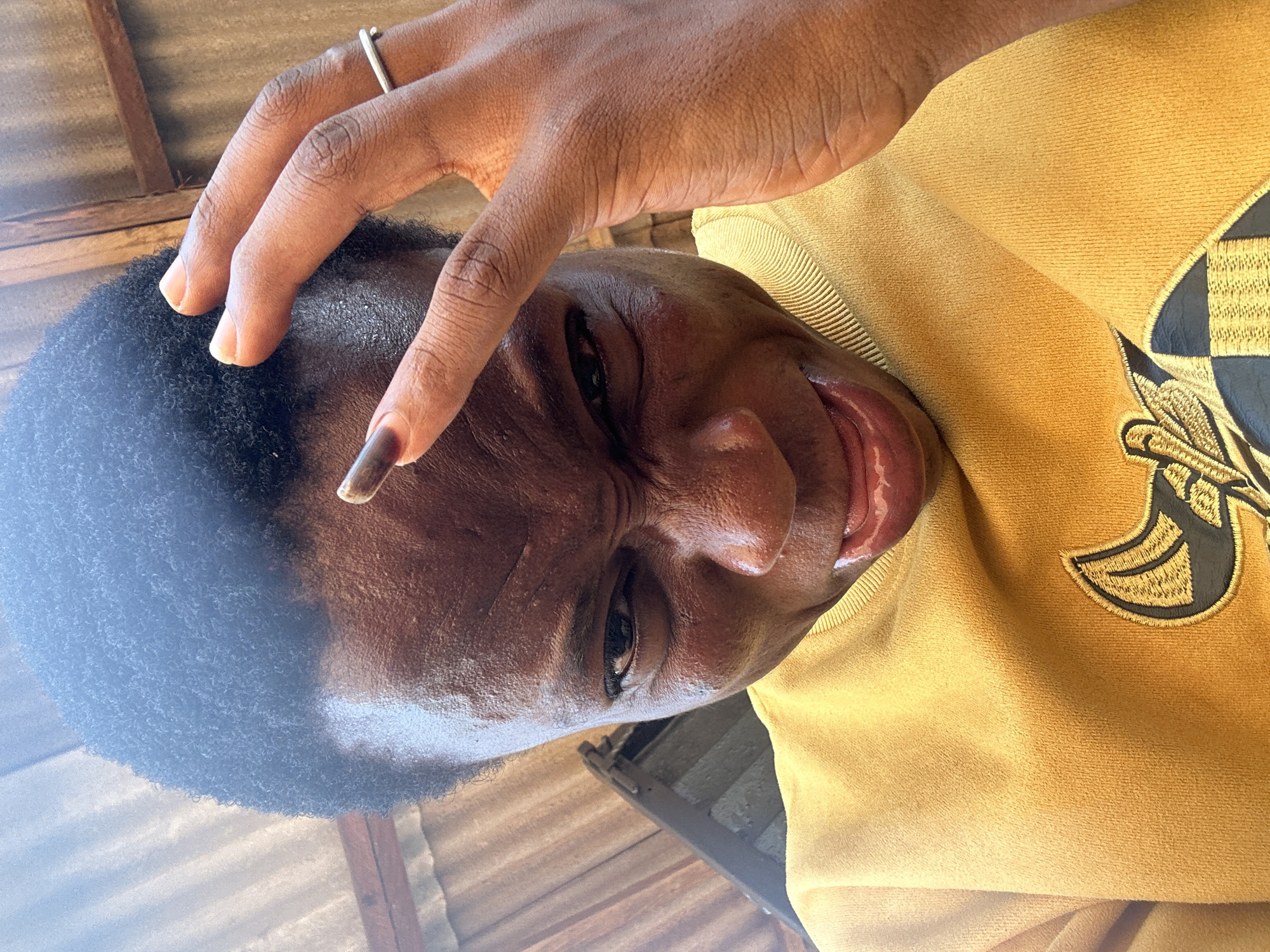 The image shows a person with dark skin wearing a yellow sweatshirt with a black and gold emblem. The person's hand is on their head, with a ring visible on one finger. The background appears to be a ceiling with wooden planks. The location is Unknown, Unknown.