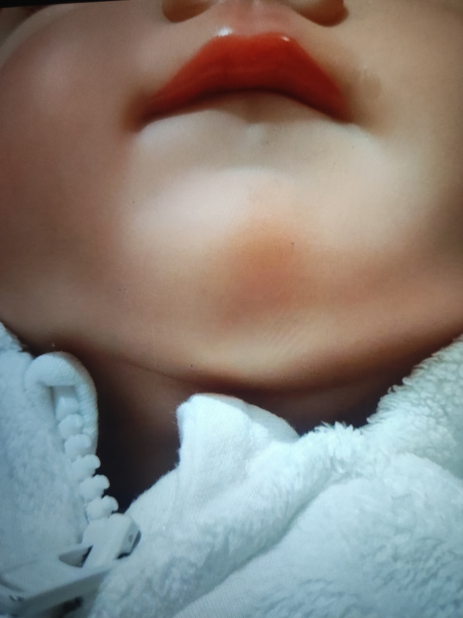 A close-up, high-angle shot focuses on the mouth, chin, and upper chest of a baby. The baby's lips are closed and appear to have a glossy red substance on them, possibly lip balm or gloss. The skin on the baby's face is smooth and peachy-toned, with a slight blush on the chin area. The baby is wearing a fluffy white zippered garment that covers their chest and neck. The background is blurred, suggesting the focus is entirely on the baby. The image appears to have been taken indoors, with soft lighting.