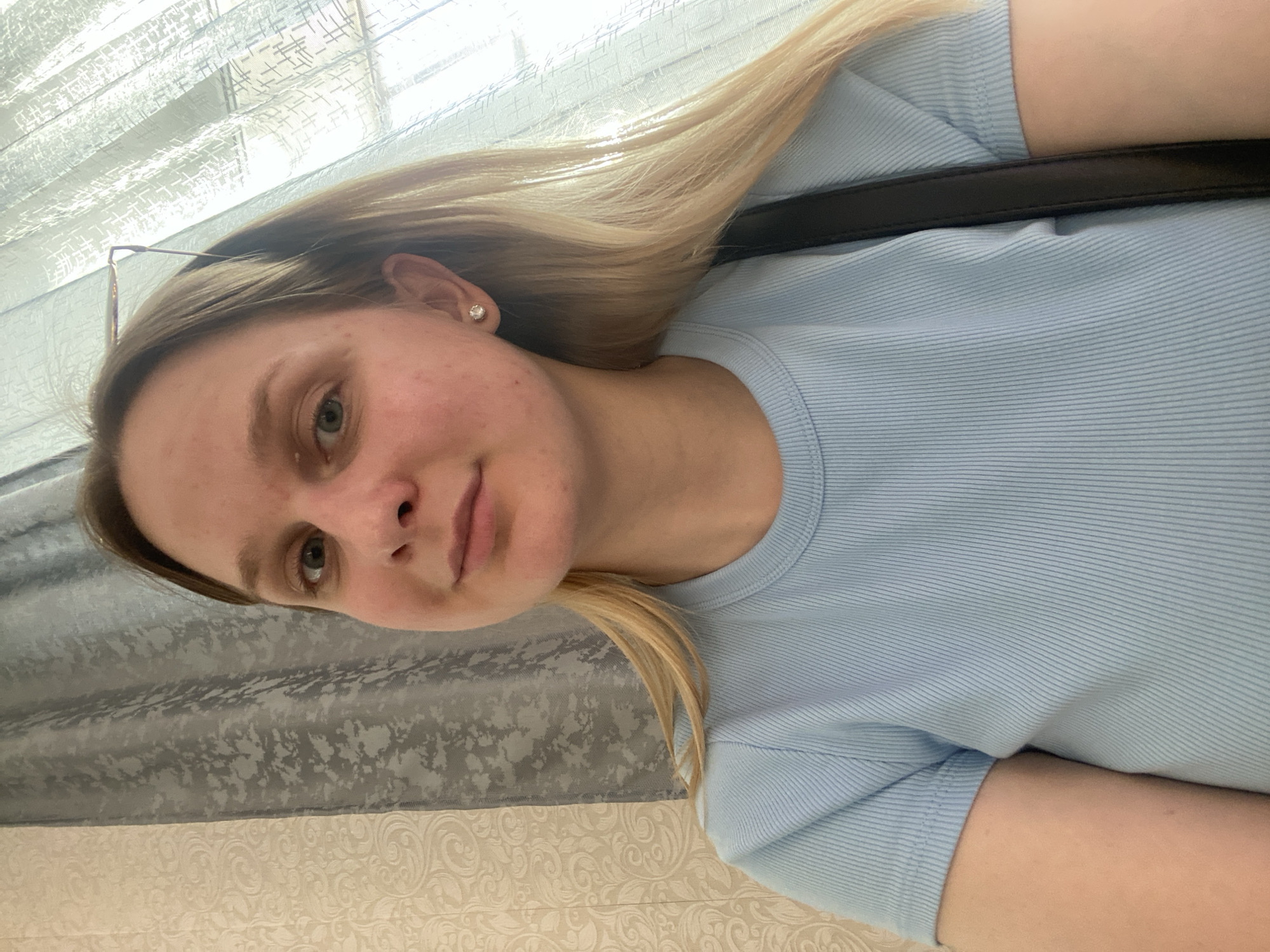The image shows a young Caucasian woman with blonde hair, wearing a light blue ribbed t-shirt. She is wearing a small diamond stud earring in her visible ear. She has some blemishes on her face. Her head is tilted to the left, and she is looking towards the camera with a neutral expression. A dark strap, possibly from a bag, is visible across her shoulder.
The background consists of blinds with a textured pattern, and below that, a patterned wallpaper. The lighting suggests it might be daytime, possibly indoors near a window. The overall scene appears to be a casual, personal photograph. No text is visible in the image. The context provided indicates the location is Chaikovsky, Russia.