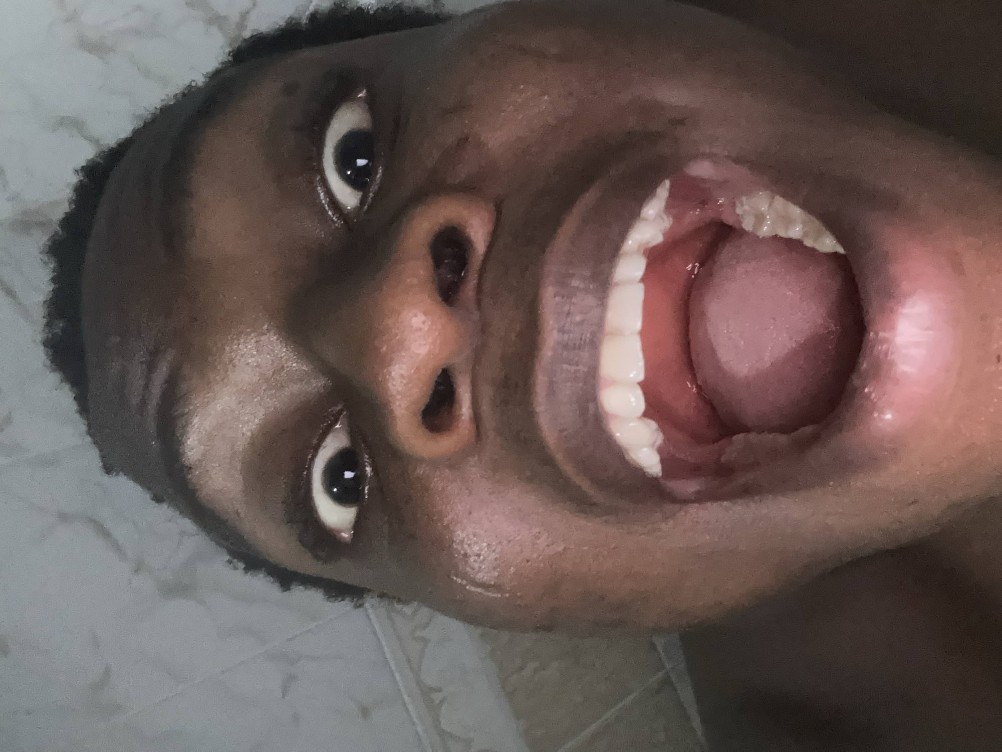 The image depicts a close-up, tilted shot of a person's face with an open mouth. The person has dark skin, dark hair, and visible white teeth. The tongue is also visible inside the mouth. The eyes are wide open. The background is blurry and appears to be a tiled surface. The location is unspecified.