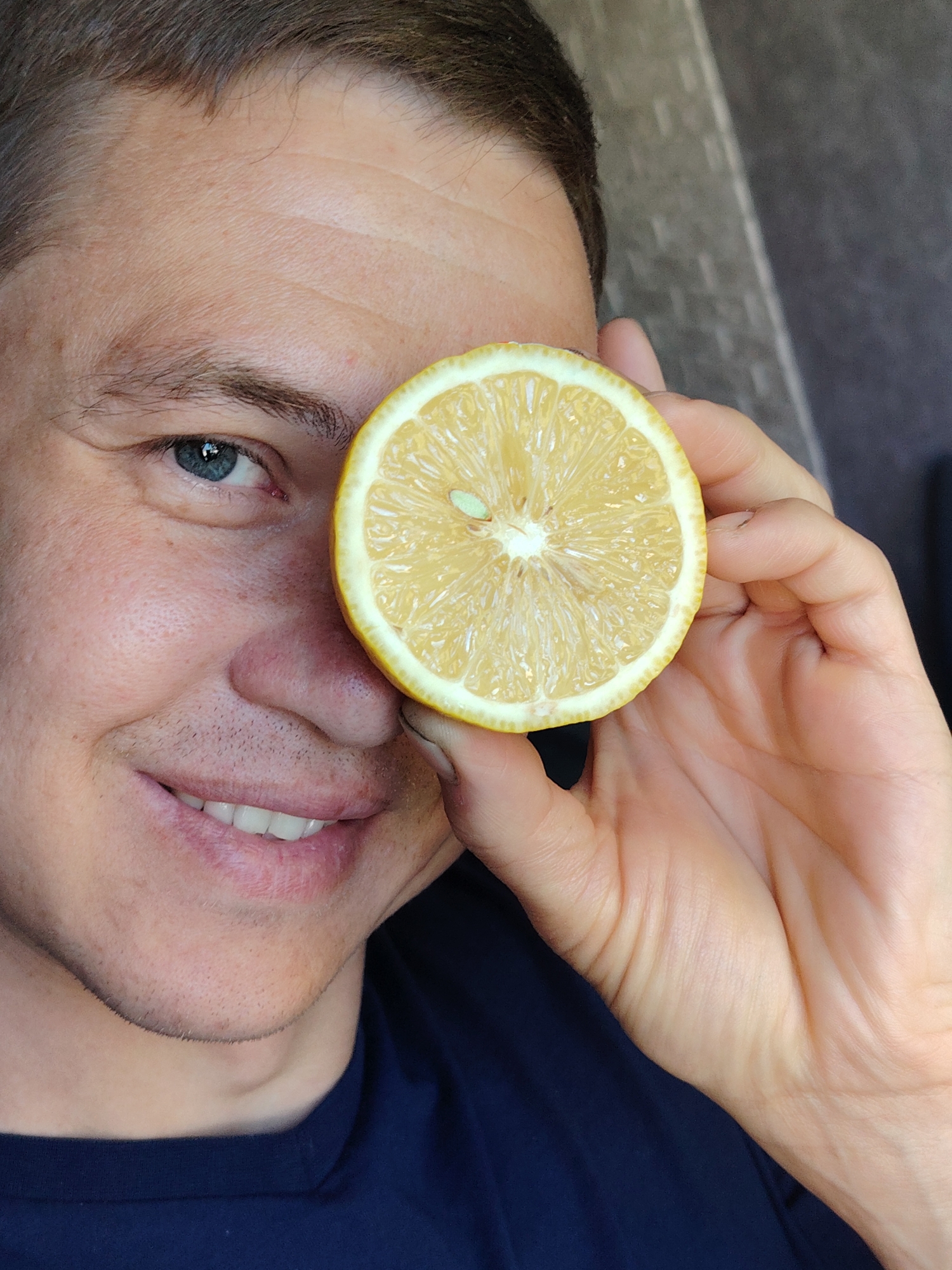 A close-up photo features a man holding a slice of lemon over his eye. The man has fair skin, short brown hair, and a visible smile with white teeth. His visible eye is blue. The lemon slice is a vibrant yellow with a thick white rind. He appears to be indoors, against a neutral-toned background. There is no indication of the location as the city of Chaikovsky, Russia, within the image itself.