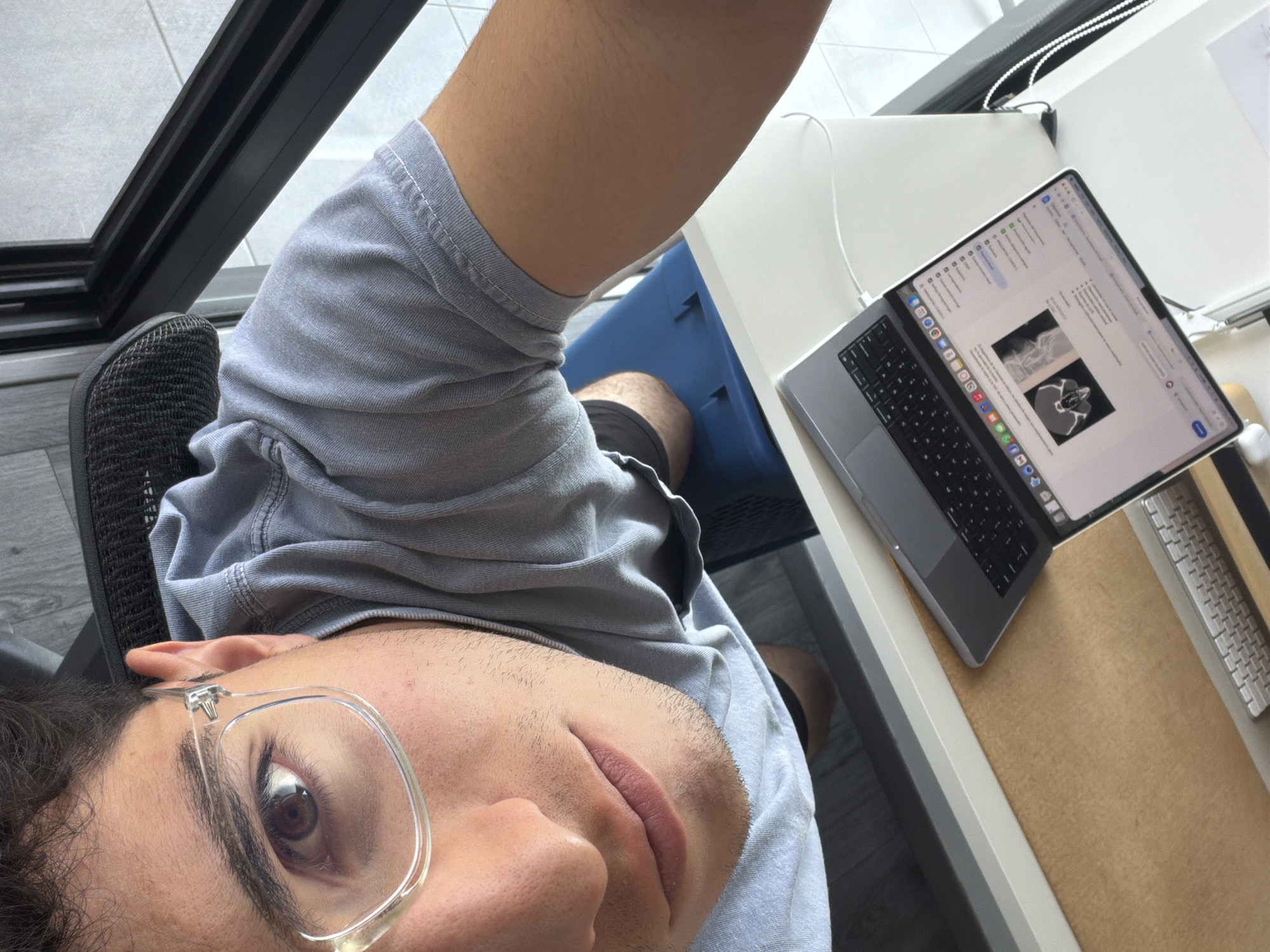 A close-up, angled view of a person working at a desk, presumed to be at home. The person, a young adult male, is wearing glasses, a gray t-shirt, and black shorts. He is seated in a black chair. On the desk, a laptop is open displaying what appears to be a medical imaging report or a research paper featuring medical imagery. A keyboard and other desk items are also visible on the desk. The background includes a window. There is no information to determine if the location is Santa Clara Ocoyucan, Mexico.