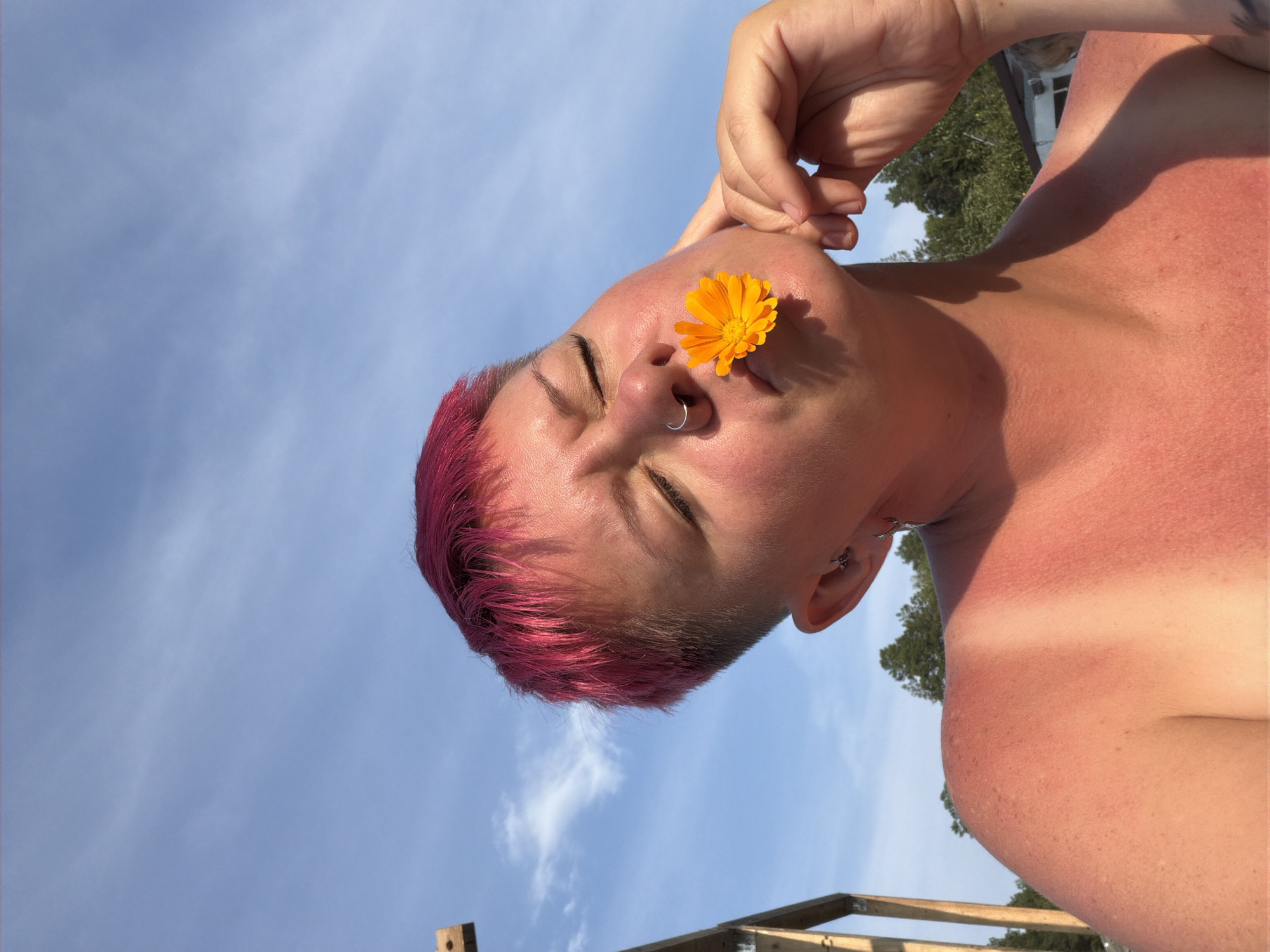 A medium shot captures a person with bright pink, short hair, and a silver nose ring, holding an orange flower between their lips. Their eyes are closed, and their right hand is raised to their cheek. The person's skin appears red and sunburned, with a distinct line where a strap may have been. They are outdoors, with a clear blue sky and scattered clouds visible above. In the background, a wooden structure and green trees are present. The scene is set in Chaikovsky, Russia.