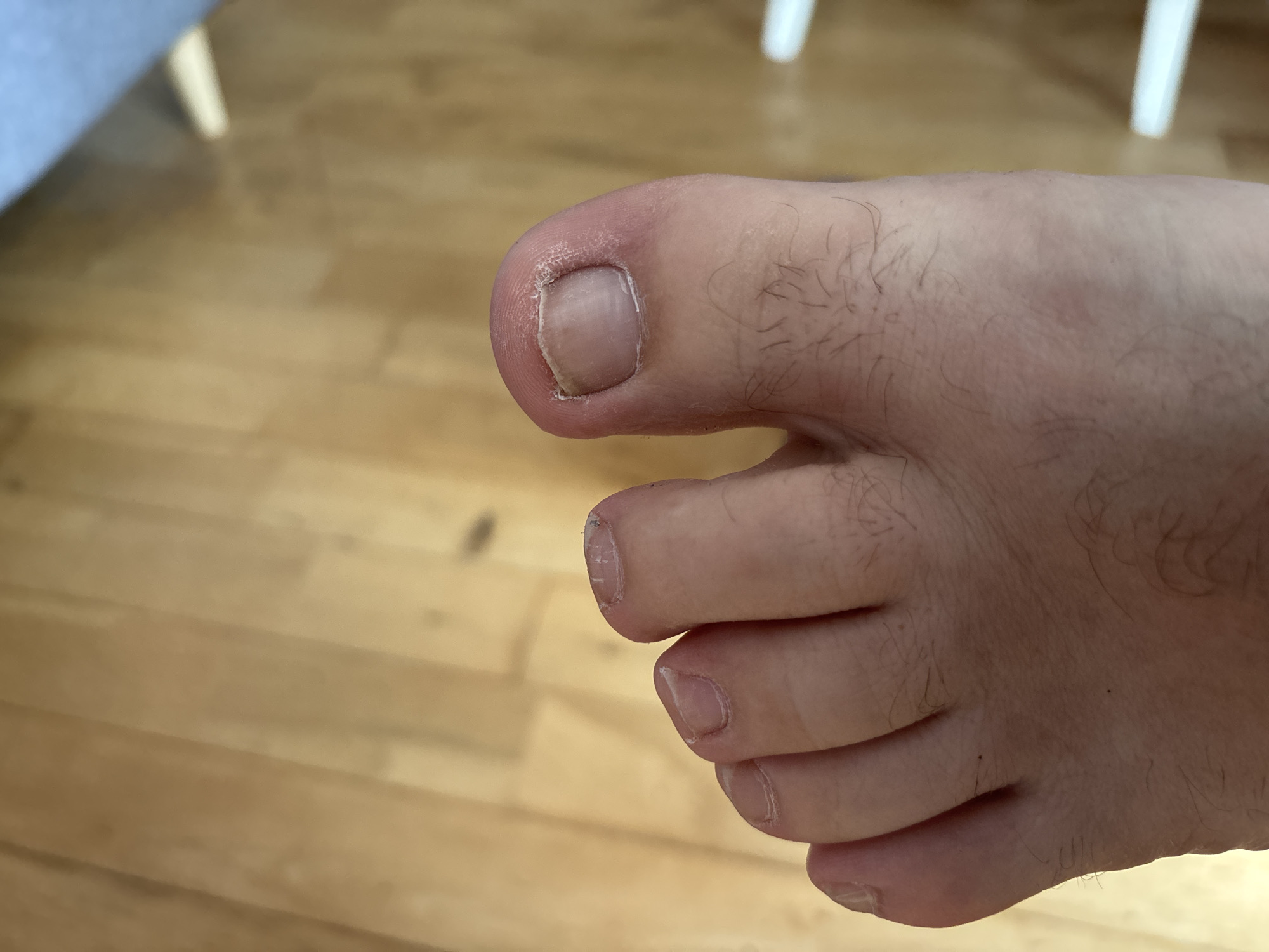 The image shows a close-up view of a person's foot, specifically the toes and toenails. The foot is resting on a light brown wooden floor. The floor appears to be made of planks. The foot has visible hair on the skin. The toenails are short and appear somewhat dry and rough around the edges. There are no visible injuries or abnormalities on the toes themselves. The background is blurred, showing a suggestion of furniture and a light blue surface, possibly a chair or sofa. The scene is indoors and well-lit. There is no information available to determine the location in the city of Cork, Ireland.