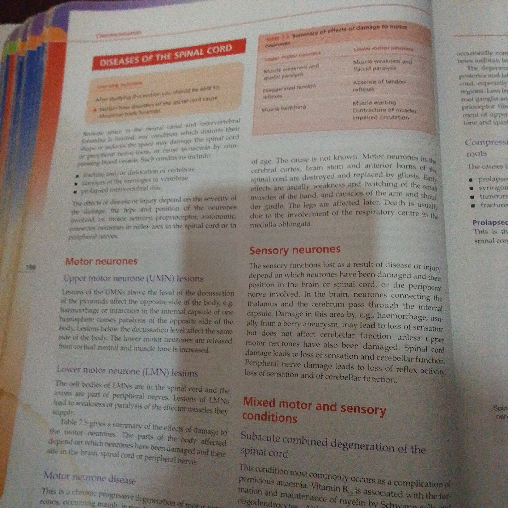 The image displays a page from a textbook about diseases of the spinal cord. The page is divided into sections discussing motor neurons, sensory neurons, and mixed motor and sensory conditions. There is also a table summarizing the effects of damage to motor neurons. The text discusses various conditions affecting the spinal cord and their consequences, such as paralysis, weakness, and loss of sensation. The printing is clear, and the page appears to be from a medical or biological textbook. There is no information or imagery in the provided picture that relates to Jalingo, Nigeria, people, subjects, objects, actions, interactions, or the environment in a forensic context.