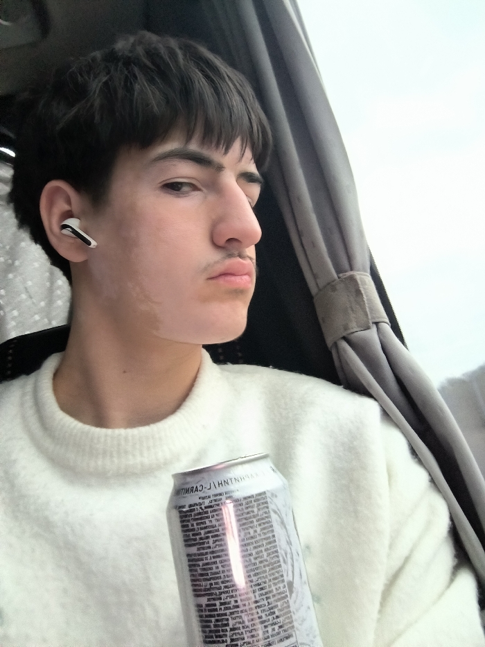 This image depicts a young male seated indoors, within what appears to be a vehicle or room with a window, in the city of Nevsha, Bulgaria. The male, estimated to be in his late teens or early twenties, has short, dark brown hair and a thin mustache. He is wearing a white, fuzzy-textured crewneck sweater. A white wireless earbud is visible in his left ear. His gaze is directed towards the viewer, with a neutral and somewhat direct expression. Visible on the left side of his face are patches of lighter or uneven skin pigmentation. In the lower right foreground, he holds a silver aluminum beverage can, partially obscuring its label, though the word "CARNITHIN" is partially legible. To the subject's right, a grey pleated curtain or fabric panel is visible, with a bright, overcast sky seen through a window beyond it.