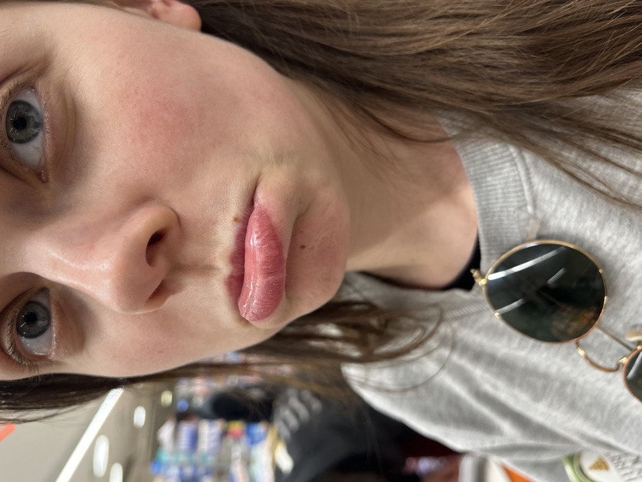 A close-up, chest-up indoor photograph captures a female individual with long brown hair, pale complexion, and light blue eyes. Her lips are pursed in a pout, appearing glossy and light pink, with a small brownish mark visible above the upper lip. She is dressed in a grey crew-neck sweatshirt, under which a black garment is visible at the neckline. Aviator-style sunglasses with gold-toned frames and dark lenses are hanging from the front of her sweatshirt. The background is blurred, showing the interior of a retail environment, likely a supermarket or pharmacy, characterized by shelves stocked with various products and bright overhead lighting. A blurred human figure in dark attire is discernible in the distant left background. The scene is situated in the city of Monsummano Terme, Italy.