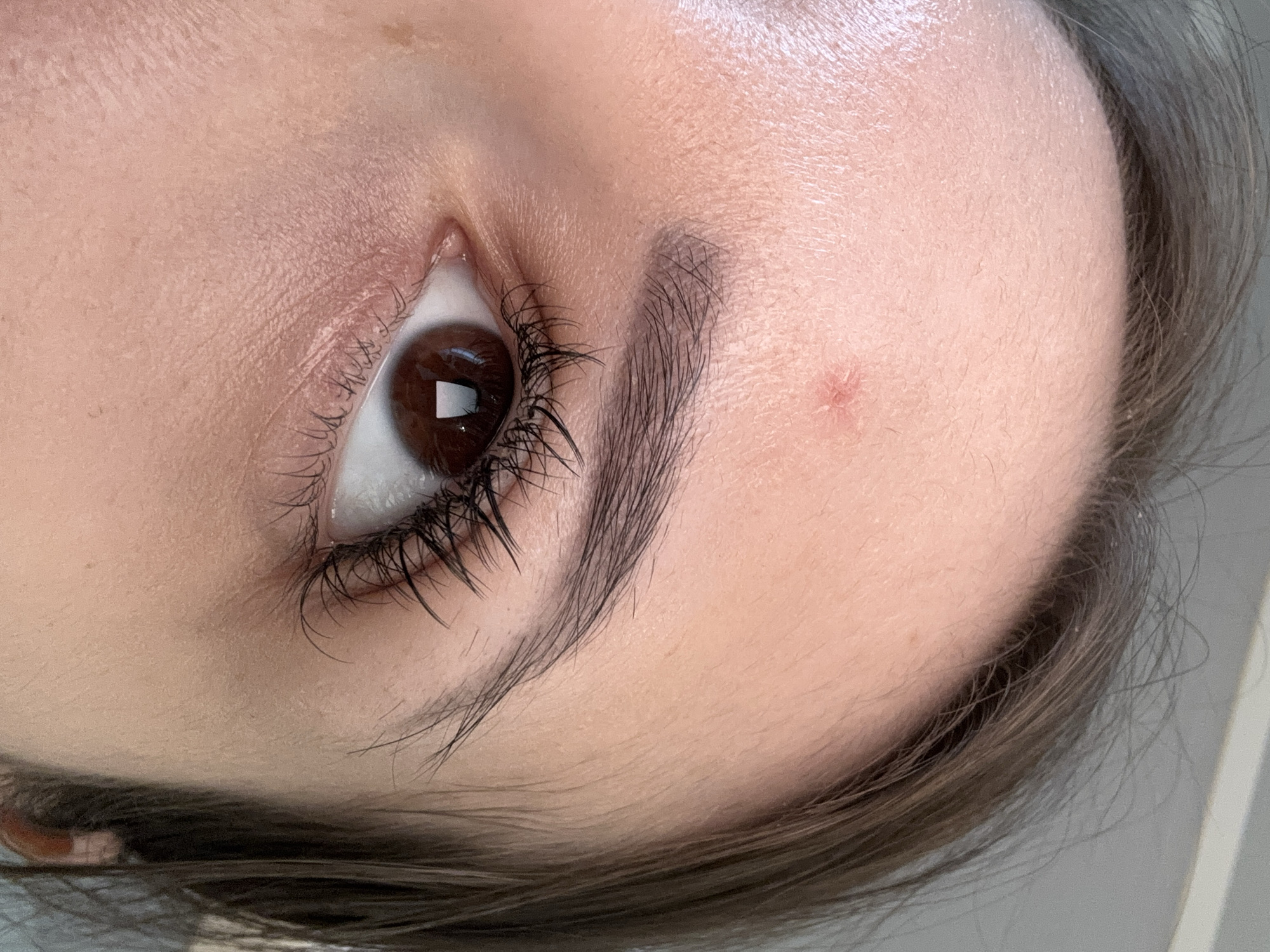 The image is a close-up, eye-level shot of a person's forehead and eye. A small, reddish-pink blemish is visible on the upper forehead. The person has dark brown hair, and their right eye is open, showing a brown iris with a reflection of what appears to be a window. The skin is smooth, with visible pores and fine lines around the eye. The background is a light gray, out-of-focus surface. There is no indication of a city or location within Russia.