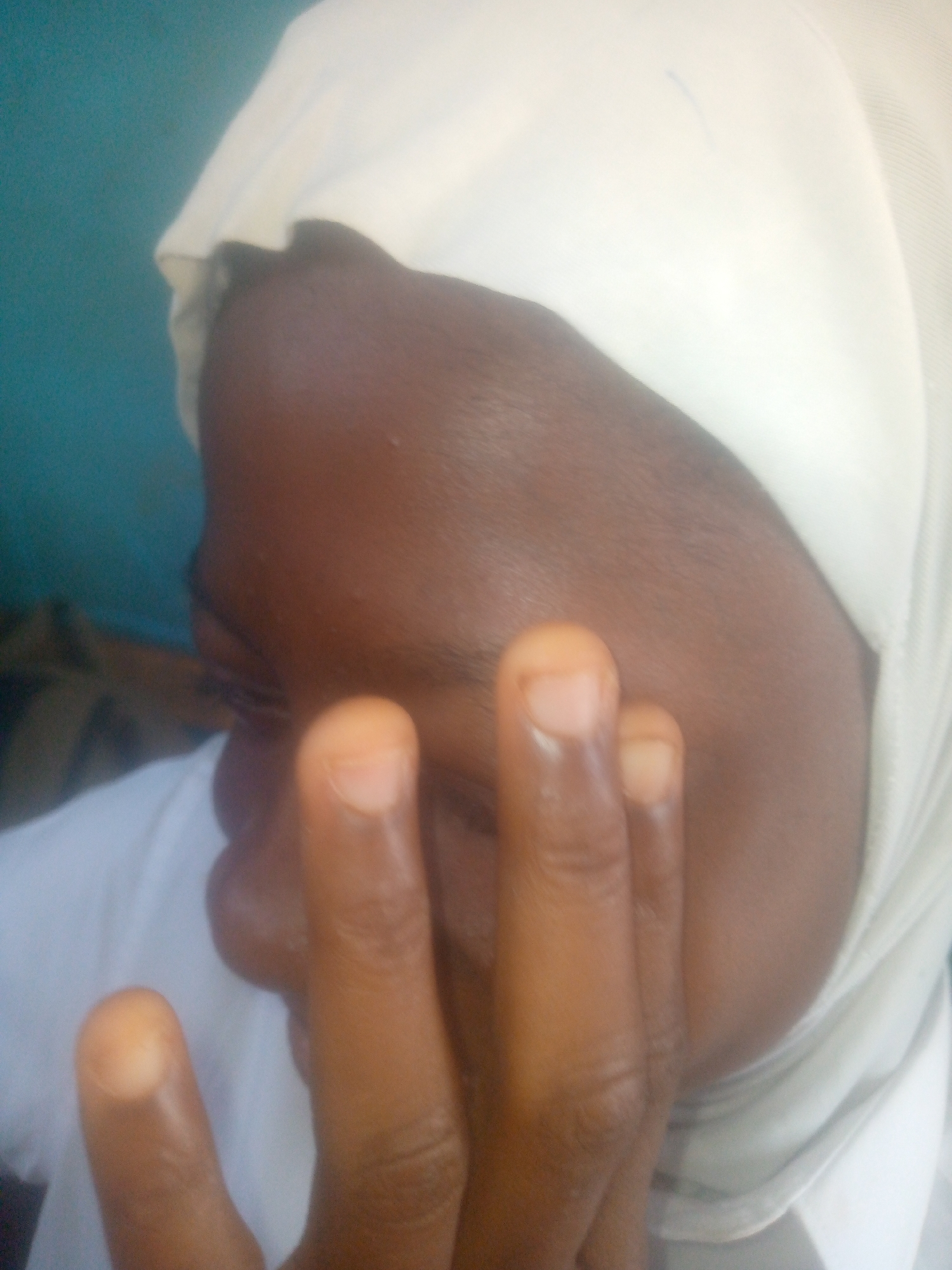 A close-up photograph shows a person's face obscured by their hand. The person is wearing a white head covering or hijab. The skin tone is dark brown. The background consists of a light blue wall and a blurred dark object. The location in Ikorodu, Nigeria, cannot be determined from the image alone.