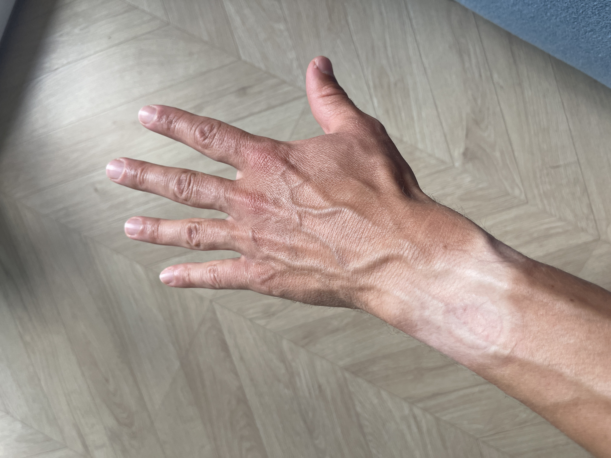 A person's left hand and forearm are visible, with prominent veins. The hand is open, with fingers extended. The skin appears tanned and slightly reddened, particularly on the back of the hand. The arm is resting on a light-colored wooden floor, which has a herringbone pattern. A sliver of blue fabric, possibly denim, is visible in the lower right corner of the frame. The overall lighting suggests an indoor setting with diffused light. There are no other people or objects of note in the immediate vicinity.