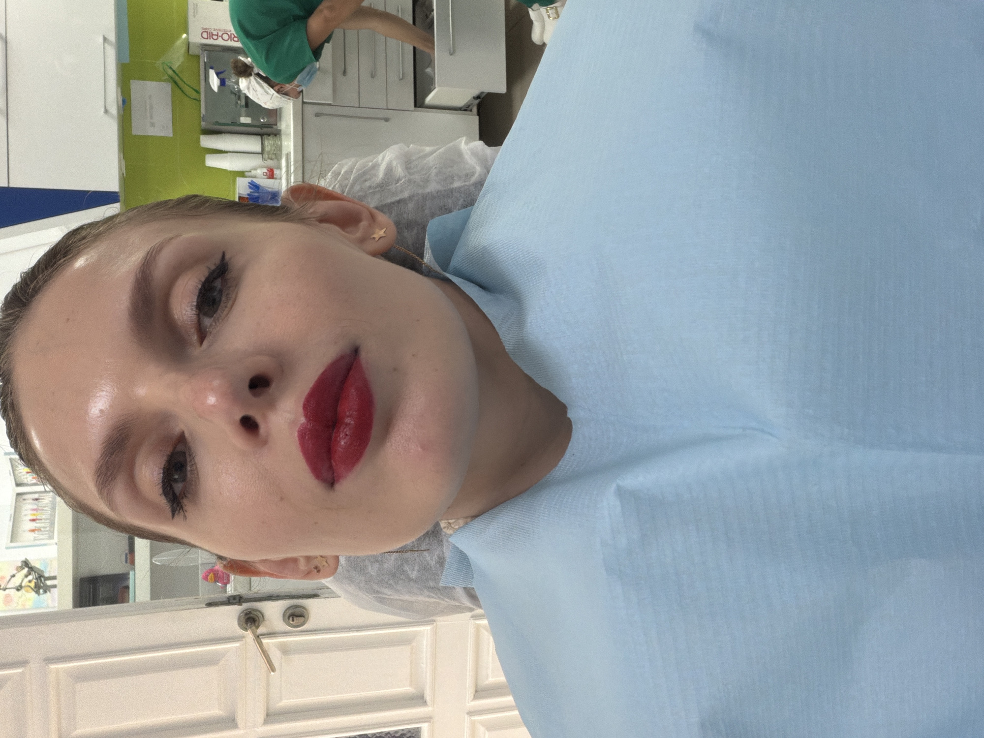 The image shows a woman in what appears to be a dental or cosmetic procedure room. She is wearing a light blue dental bib or covering, and her lips are heavily made up with a deep red lipstick. She is lying in a reclined position, likely in a dental chair or similar. In the background, a person in green scrubs, potentially a dentist or assistant, is working. The environment includes medical or dental equipment and cabinetry. The image may have been taken in a dental clinic or medical office in Budva, Montenegro.