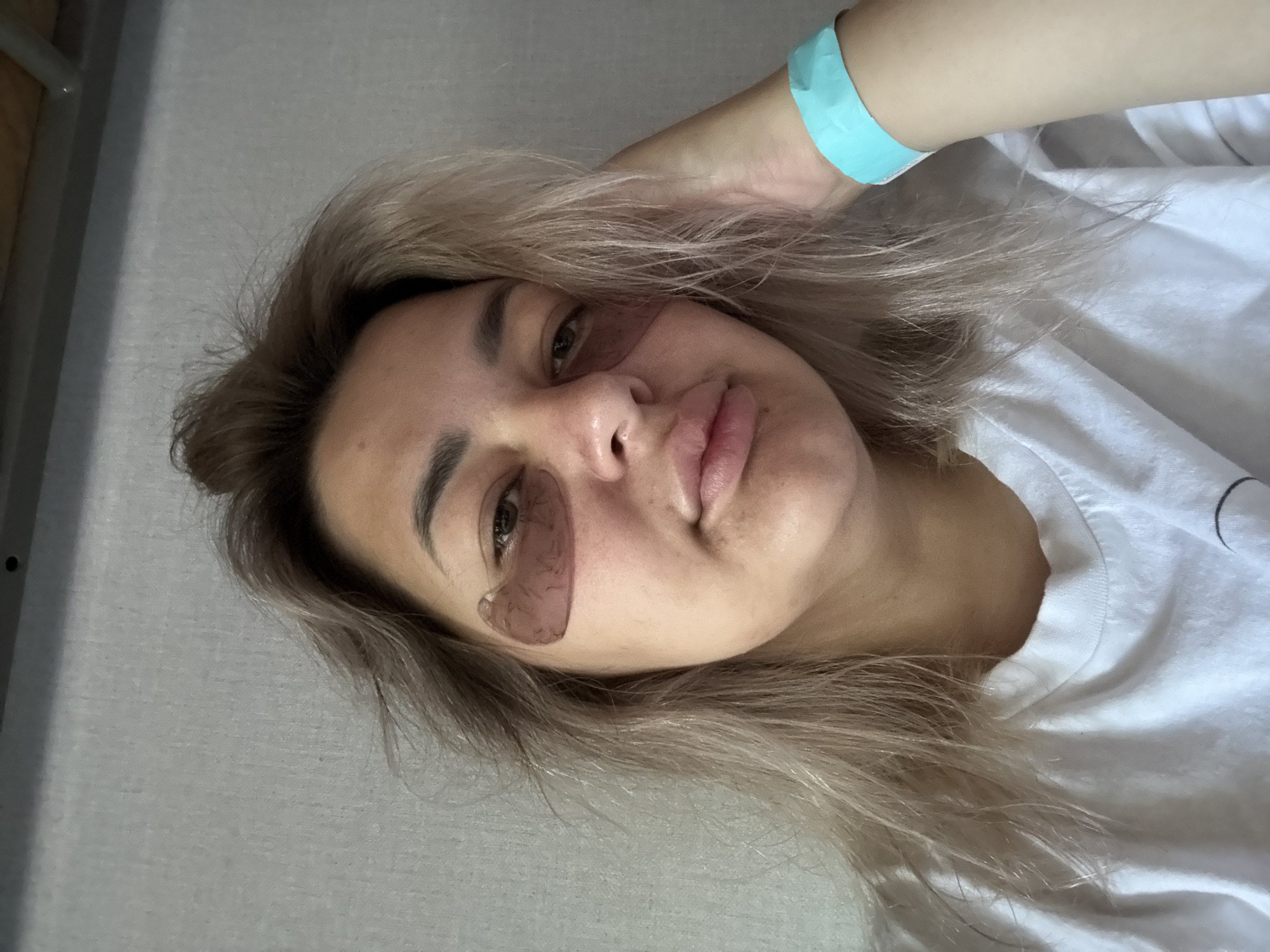 A medium shot shows a woman with blonde hair, light skin, and eye patches on her face. She is wearing a white t-shirt and a blue wristband on her right arm. The background is a plain, light-colored wall.