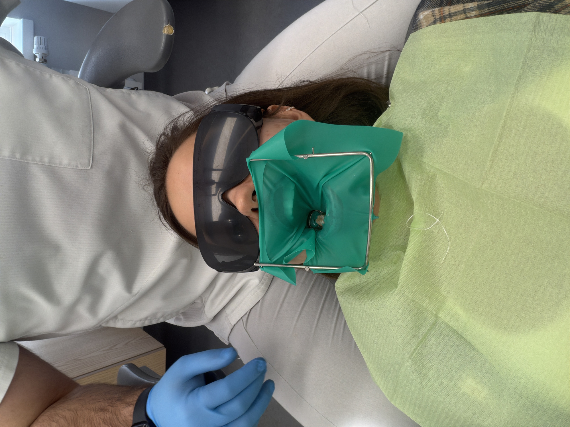 The image depicts a patient undergoing a dental procedure in a clinic setting. The patient is lying on their back in a grey dental chair, positioned with their head towards the left side of the frame. They have long, dark hair and are wearing dark, wraparound safety glasses over their eyes. A green dental dam, stretched over a metal frame, is isolating a tooth that appears to be undergoing treatment or restoration, visible through a small opening in the dam.
The patient is dressed in light-colored attire, possibly a white shirt and light grey pants. A light green, disposable bib covers their chest and lap. A plaid blanket or throw is partially visible near the patient's head.
In the lower-left corner of the image, the arm of a medical professional, likely a dentist or assistant, is visible. This arm is hairy, and the hand is covered with a bright blue surgical glove. A watch is visible on the wrist.
The background elements include a portion of a grey dental chair and, further back, a white thermostat or valve, possibly part of a heating or ventilation system. The floor appears to be made of light-colored wood or laminate. The overall scene suggests a professional and sterile environment typical of a dental office. No visible text is discernable in the image, and the patient's emotions are not visible due to the protective gear. The time of day cannot be determined.