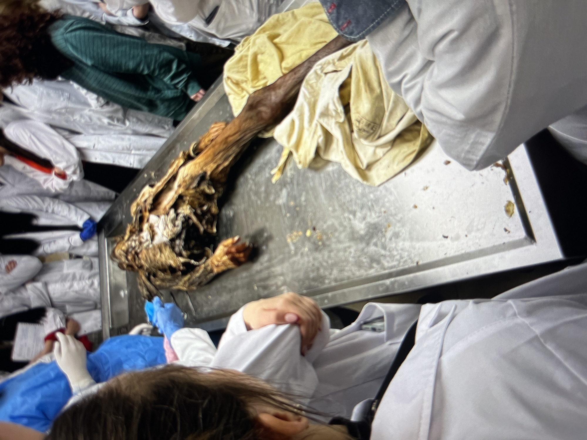 A body, partially covered in a yellow cloth, lies on a metal table. Several people in white lab coats surround the table, some wearing gloves. The location appears to be a medical or forensic setting.