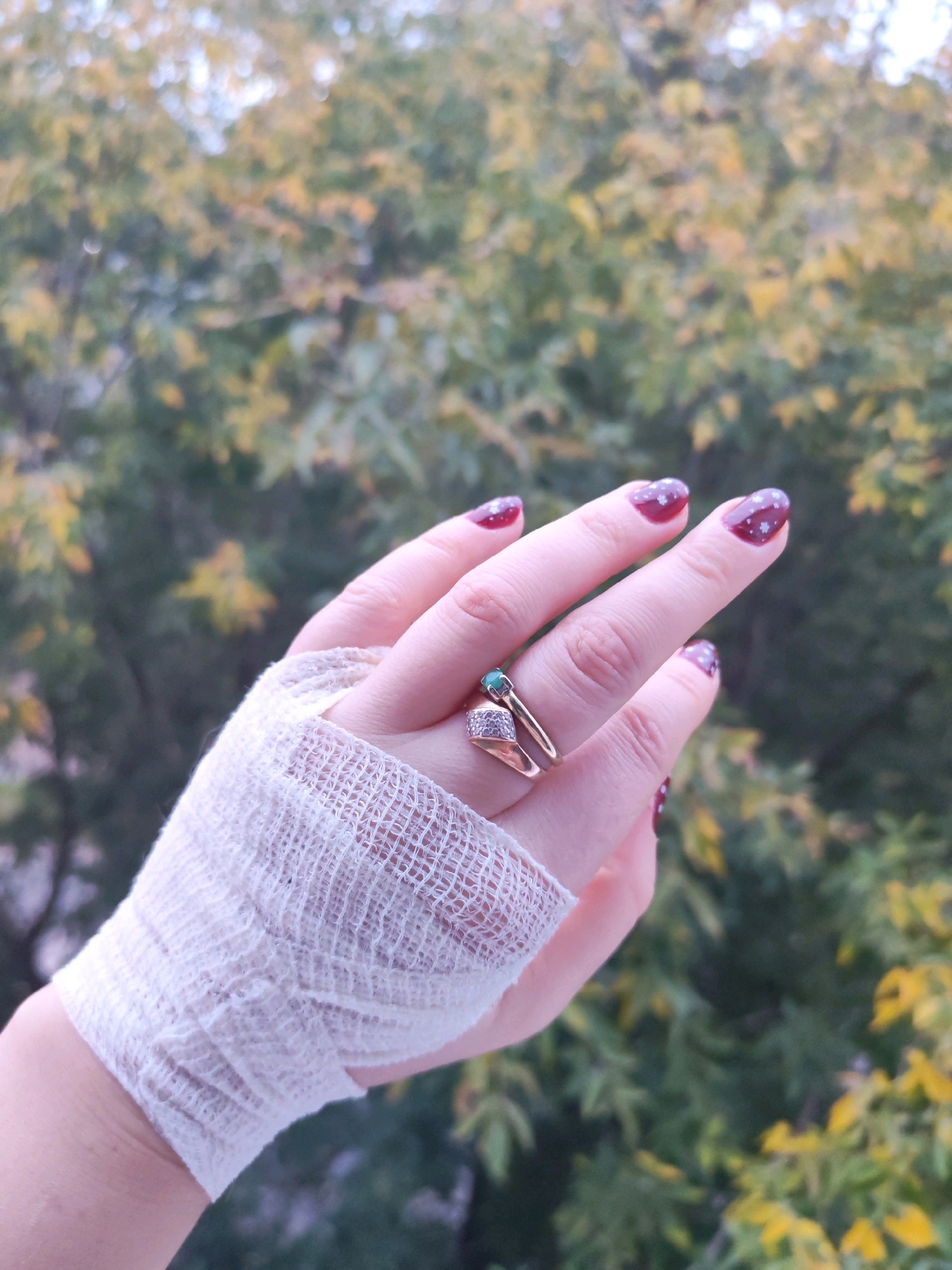 A close-up, medium shot shows a person's left hand, bandaged from the wrist up, resting against a blurred background of autumn foliage. The hand has dark red nail polish with small white star-like designs. Two rings are worn on the ring finger: a gold band with a small aquamarine stone and a slightly thicker gold band below it adorned with small, clear stones. The bandage is a light beige gauze material wrapped multiple times around the wrist and lower hand, secured with visible cross-hatching of the fabric. The background is out of focus, revealing a mix of green and yellow leaves, suggesting an outdoor setting with trees, possibly in a park or residential area. No specific landmarks or recognizable elements of Izhevsk, Russia are visible in the image.