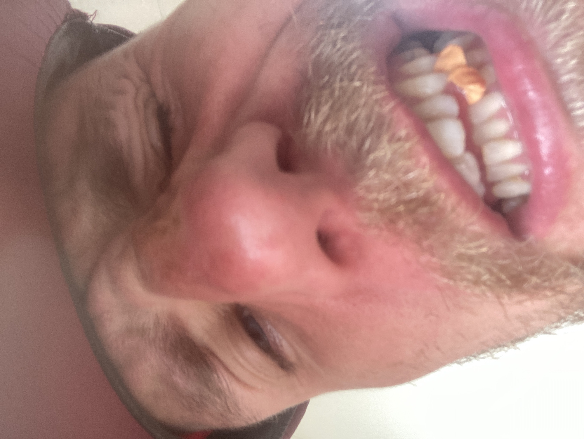 A close-up, tilted, upward-facing view of a man's face. The man has fair skin, a light-colored beard and mustache, and is smiling, revealing teeth with food debris. His eyes are mostly closed. The environment and any potential location in Mũi Né, Vietnam, are not discernible.