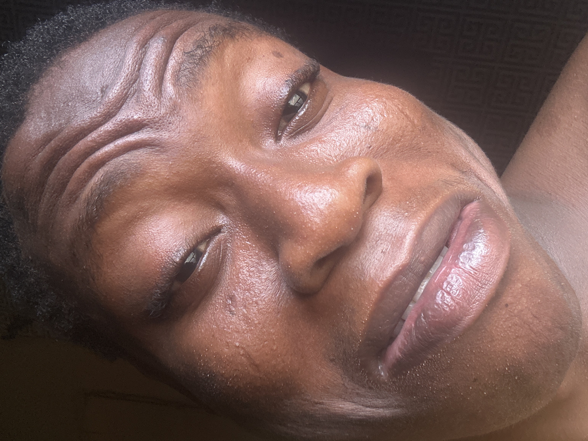 A close-up, high-angle shot captures the face of a person with dark skin. The individual's head is tilted, with their gaze directed upwards and slightly to their right. Their forehead is deeply furrowed with several horizontal wrinkles, suggesting an expression of thought, concentration, or perhaps slight discomfort, yet a subtle smile plays on their lips, revealing a glimpse of their teeth.
The person's skin appears to have a natural sheen, possibly due to oiliness or perspiration, with prominent highlights across the forehead, nose, cheeks, and lips. Visible pores and slight skin texture are noticeable, particularly around the T-zone and chin. Their dark, curly hair is visible framing the forehead and temples. The eyes are open, dark, and reflect the light source. The lips are full and glossy.
The background is dark and indistinct, with a subtle geometric pattern visible in some areas, hinting at an indoor setting. The lighting is soft but highlights the contours and texture of the face. There are no clear indicators of the time of day, weather, or specific location. No text is visible in the image.