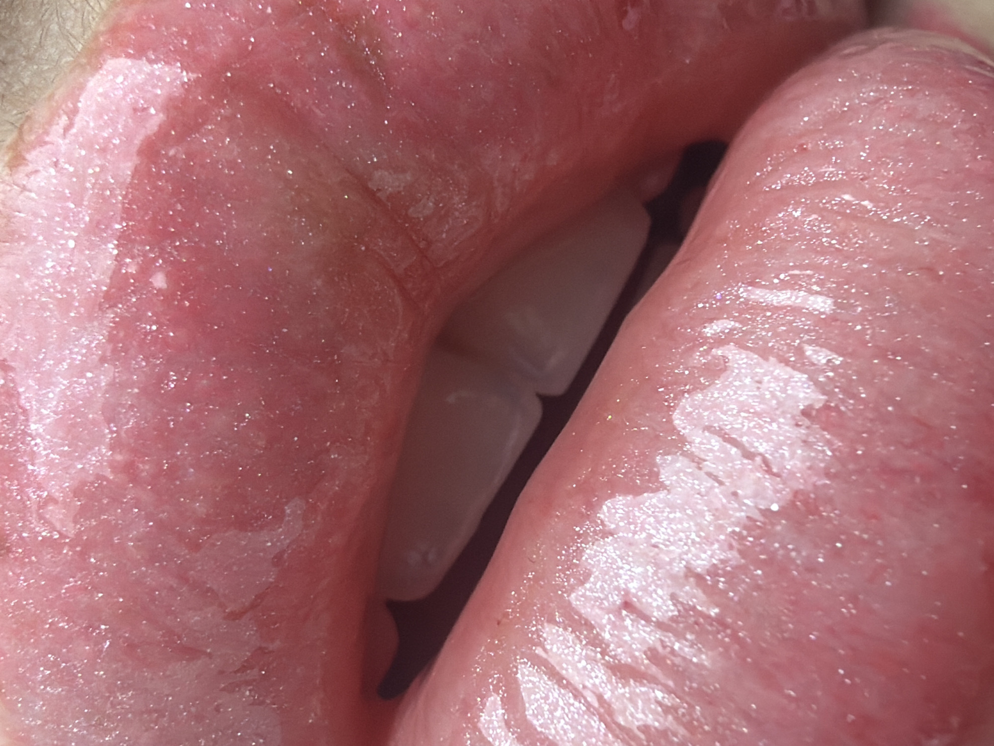A close-up, macro photograph shows a pair of lips, appearing pink and moist, with visible texture and subtle shimmering highlights. The lower lip fills the foreground, exhibiting natural lines and slight imperfections. The upper lip is visible behind, slightly parted to reveal a glimpse of teeth, which are pale. The overall impression is one of intimacy and detail, focusing on the tactile qualities of the skin. The scene is indoors, and no specific location in the city of Unknown, Russia can be determined from the image.