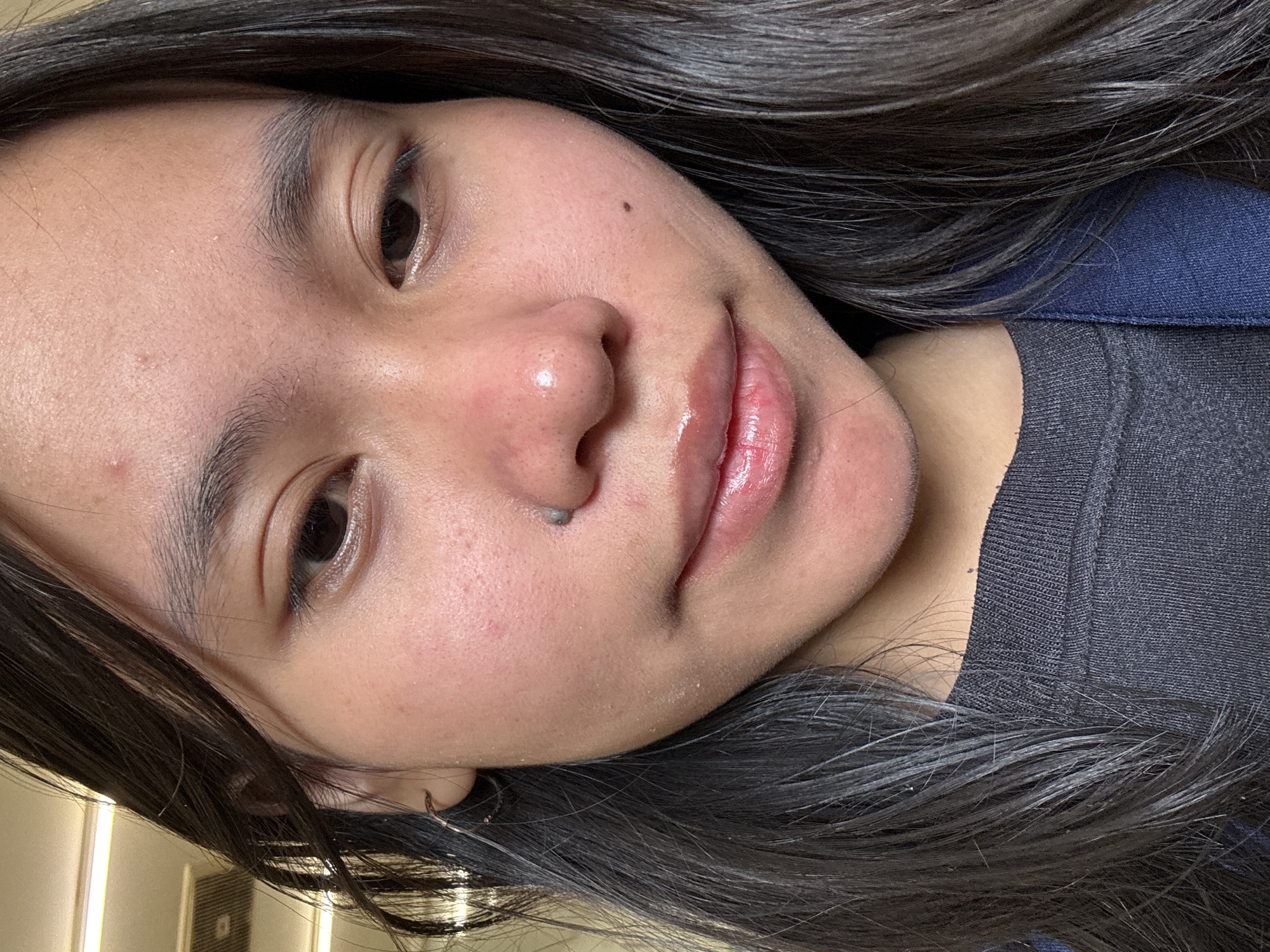 A close-up, head-and-shoulders portrait of a young woman with dark hair and brown eyes, taken from a slightly upward angle. The woman is wearing a dark gray long-sleeved shirt under a dark blue jacket. Her hair is dark and falls around her face and shoulders. She has a mole on her nose and another on her cheek. Her skin shows some redness and small blemishes. The background appears to be an indoor setting with fluorescent lighting visible at the top of the frame. No specific location in East Jakarta, Indonesia, is identifiable from the image.