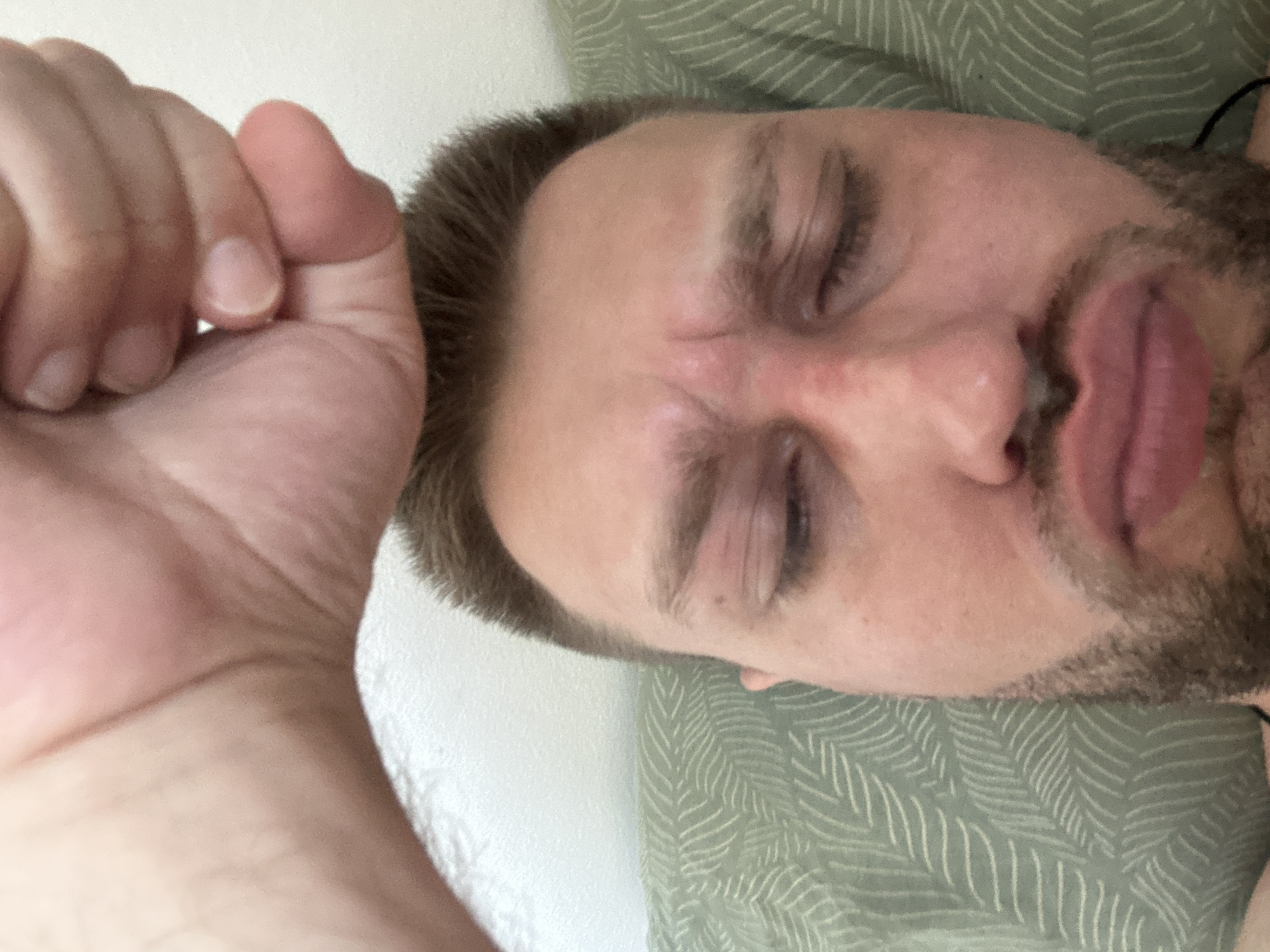 A close-up shot shows a man lying on his side, with his eyes closed. A fist is held above his forehead. The man has light brown hair, a beard, and stubble. His skin appears flushed around his nose and eyes. He is lying on a green pillow with a white leaf pattern. The background is a white wall. There is no indication of the location in the city of Zvezdara Urban Municipality, Serbia.