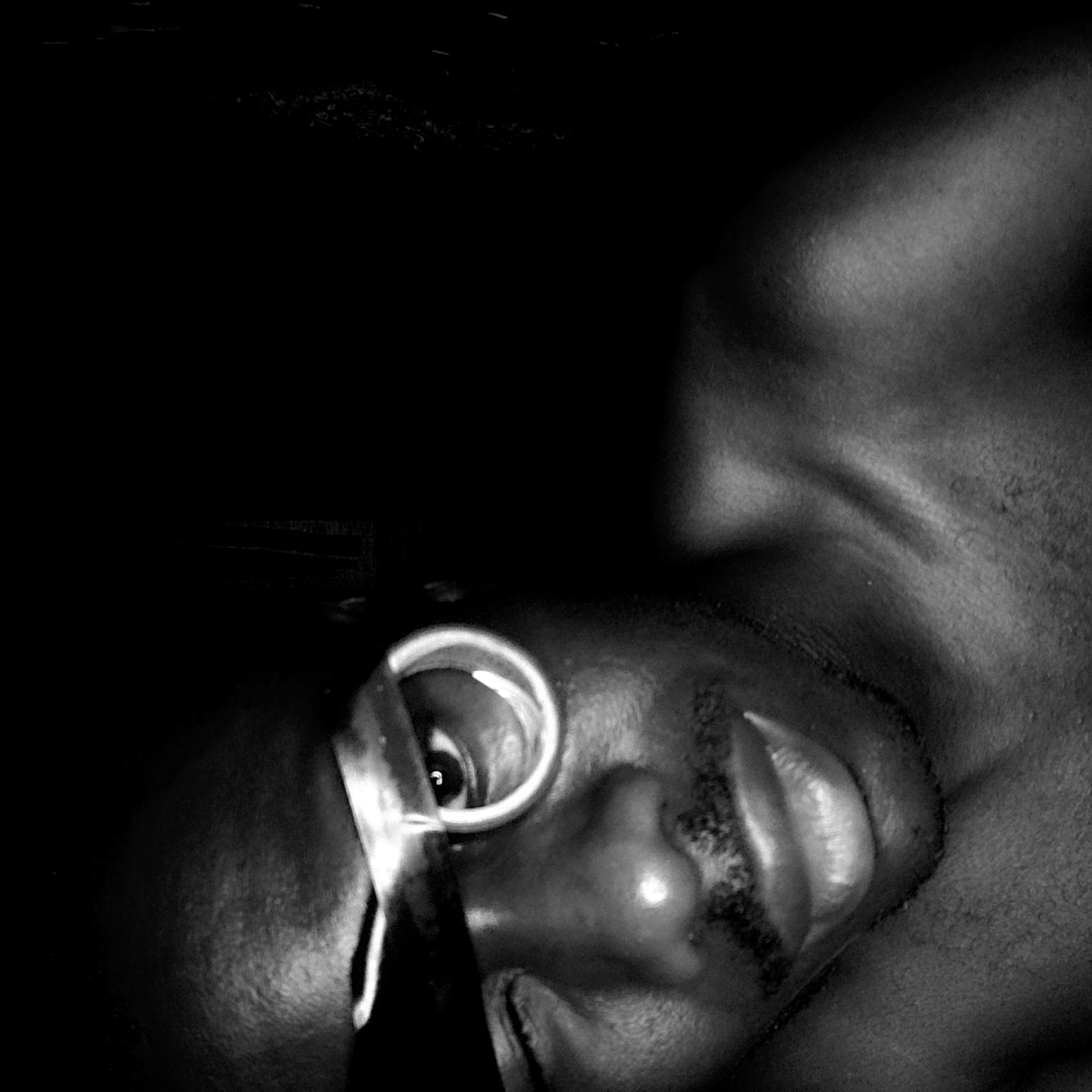 The black and white image depicts a close-up of a person's face with an otoscope inserted into their left ear. The person's eyes are partially visible. Their facial features include a nose and lips. The skin texture is evident, including facial hair. A portion of the person's neck and shoulder is visible. The background is dark and indistinct. There is no identifiable evidence to link the scene to Narayi, Nigeria.