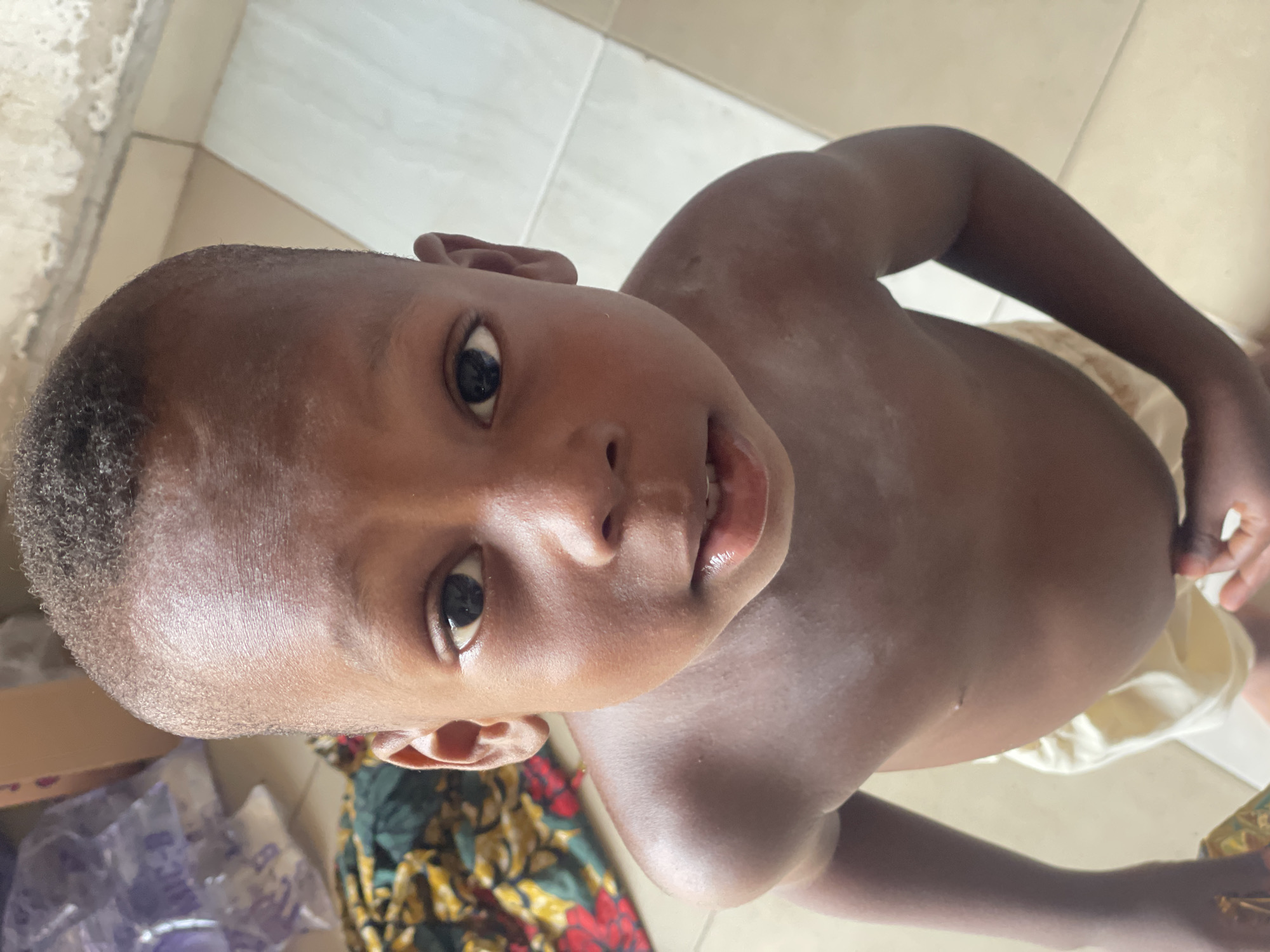 A close-up, high-angle portrait captures a young Black child, likely a boy, looking directly at the camera with wide, dark, curious eyes and a slightly open mouth. He has very short, dark, curly hair. The child appears to be bare-chested, revealing skin with some lighter, possibly dry or ashy, patches on his shoulders and chest. A light-colored fabric or garment is visible wrapped around his lower body.
The setting appears to be indoors, with light-colored tiled flooring and a simple, light-colored wall visible in the background. Towards the lower left, there are glimpses of patterned fabric, possibly a wrap or mat, featuring green, yellow, and red colors, along with some indistinct plastic items. The lighting is bright and even, suggesting it is daytime. The image conveys a sense of innocence and direct engagement. There is no visible text. The context places this scene in Lokoja, Nigeria.