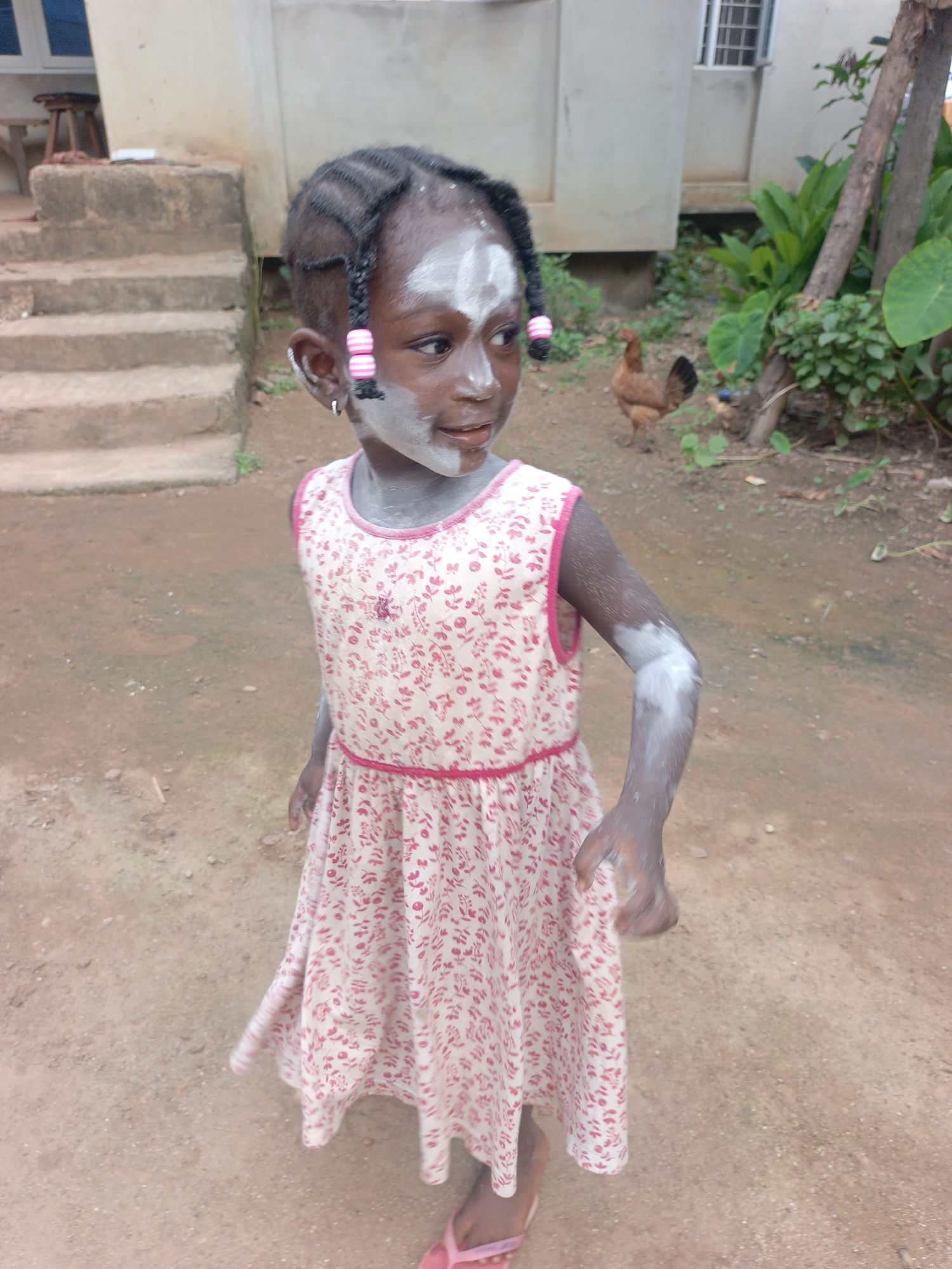 In Akwanga, Nigeria, a young girl with dark skin, wearing a pink and white floral dress and pink flip-flops, stands outdoors. Her hair is braided, with pink beads adorning one braid. White powder is applied to her face, arms, and chest. She is barefoot and appears to be in a somewhat unpaved area, with dirt on the ground and some greenery in the background. A short set of concrete stairs is visible to her left. In the background, two chickens are present, one brown and one with darker plumage, near some leafy plants and a tree. The building behind her is light-colored with a window.