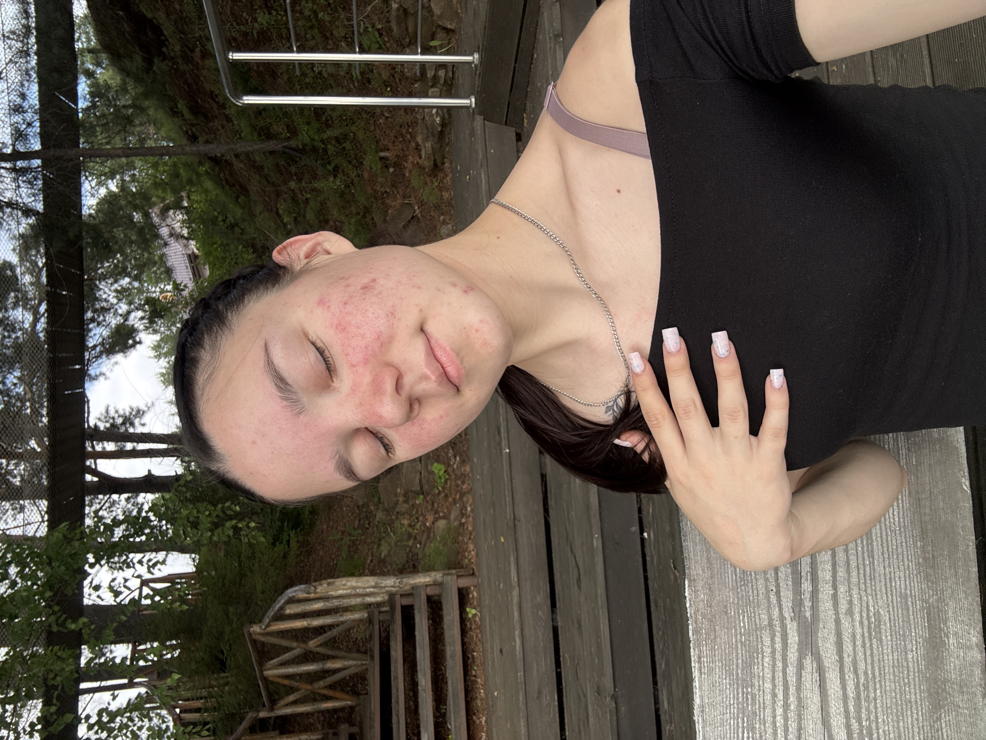The media file shows a close-up, horizontally oriented shot of a young person, possibly a woman, with their eyes closed and a relaxed expression. They are wearing a black top with a light purple bra strap visible. A silver chain necklace is around their neck. Their hand, with manicured nails featuring a light, speckled design, is resting on their chest. The person has braided dark hair and visible acne on their face, particularly on the cheeks.
The background suggests an outdoor setting, possibly a park or a wooden deck, with trees and foliage visible. A wooden railing is present in the lower left of the frame, and what appears to be another wooden structure further back. The lighting suggests it might be daytime. The overall mood is tranquil and candid. There is no visible text in the image.