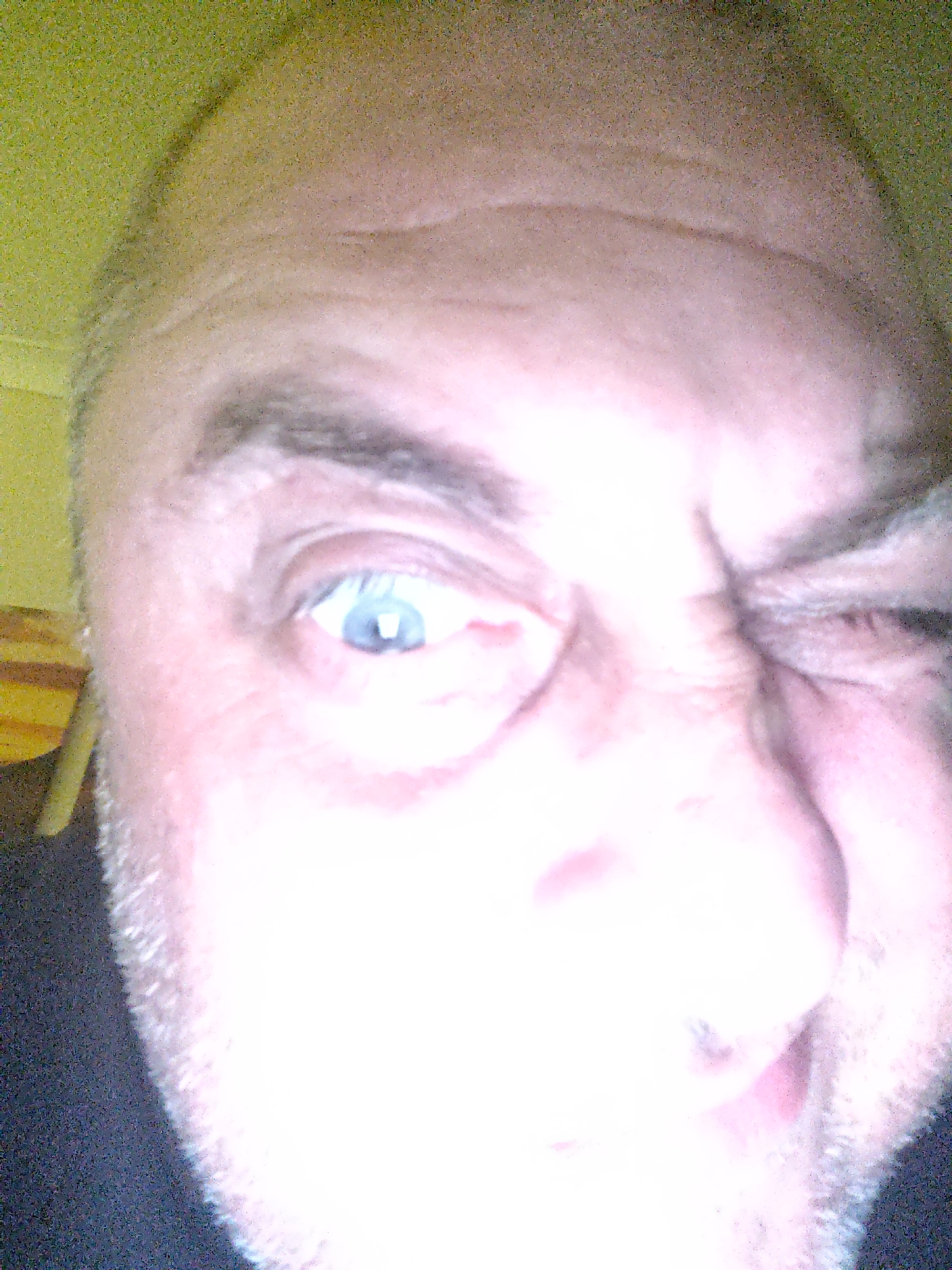 A highly overexposed, close-up image shows the face of an adult individual, likely male, dominating the frame. The subject's left eye (viewer's right) is wide open, revealing a bright blue iris, while the right eye is squinted shut. The mouth is slightly open, suggesting an expression of surprise or a playful grimace. Visible stubble covers the chin and lower cheeks, and dark eyebrows are prominent.
A significant portion of the face, particularly the center including the nose and mouth area, is severely overexposed, appearing as a bright white glare. This intense lighting, possibly from a direct flash or screen, obscures fine details of the skin. The upper forehead shows some lines or wrinkles.
The background is blurry and indistinct. On the upper left, there's a soft, greenish-yellow area, possibly a wall or fabric. A hint of a striped pattern in yellow and brown is visible behind the subject's left ear. No visible text is present in the image. The photo appears to be an informal self-portrait or selfie.
