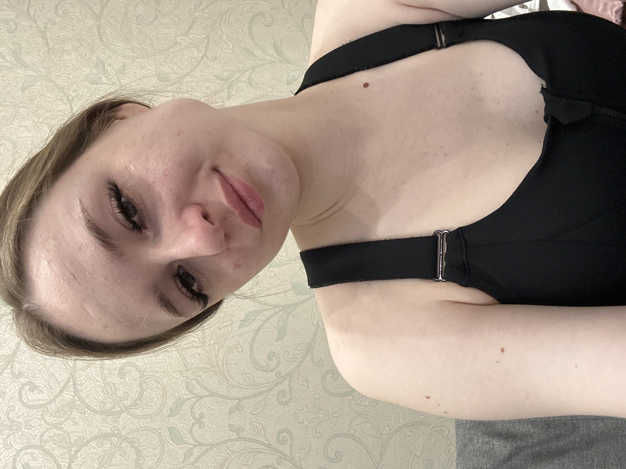 The image shows a fair-skinned individual with light brown hair and visible eyelashes, facing the camera at an angle. The person is wearing a black garment with straps, potentially a top or bra. Their skin exhibits minor imperfections such as freckles and blemishes. The background is a patterned wallpaper with a light color scheme. The image orientation is tilted. The location and specific actions within the scene are not discernible.