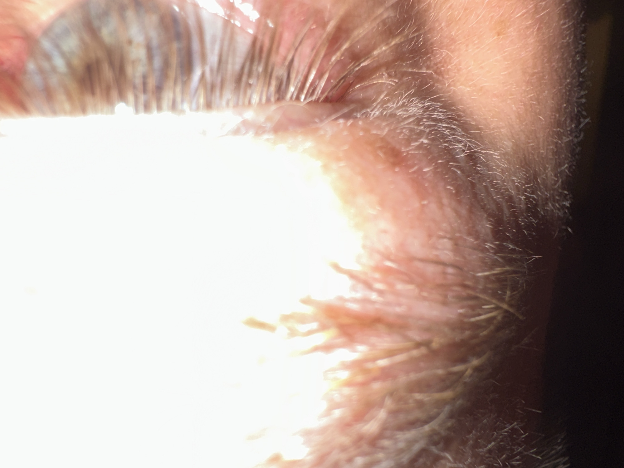 The image is a close-up, macro shot of an eye and surrounding skin. The eye appears to be open, with eyelashes clearly visible. The skin is slightly flushed and appears to have fine hairs, possibly from an eyebrow or facial hair. The lighting is very bright, with a strong light source on the right side of the frame, creating a glare and washing out some details. The background on the left is dark, suggesting an indoor environment. There is no information in the image to indicate a specific location in Zvezdara Urban Municipality, Serbia.